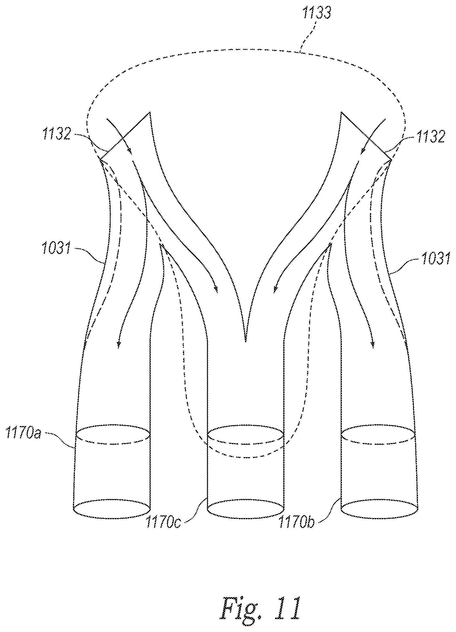 Patent US12583581 Figure 11 – Commercial supersonic aircraft and associated systems and methods