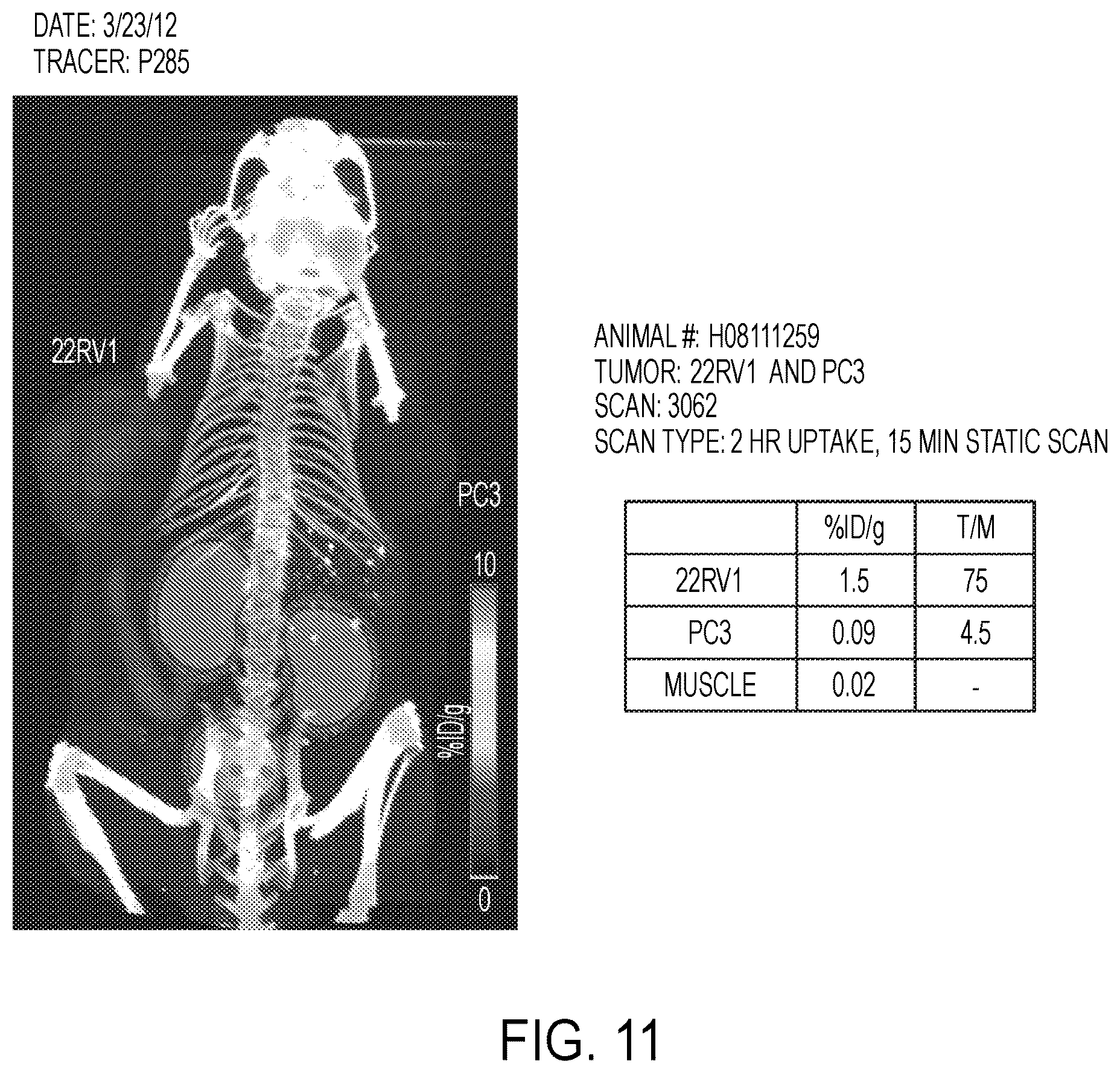 Patent US12583887 Figure 11 – PSMA imaging agents