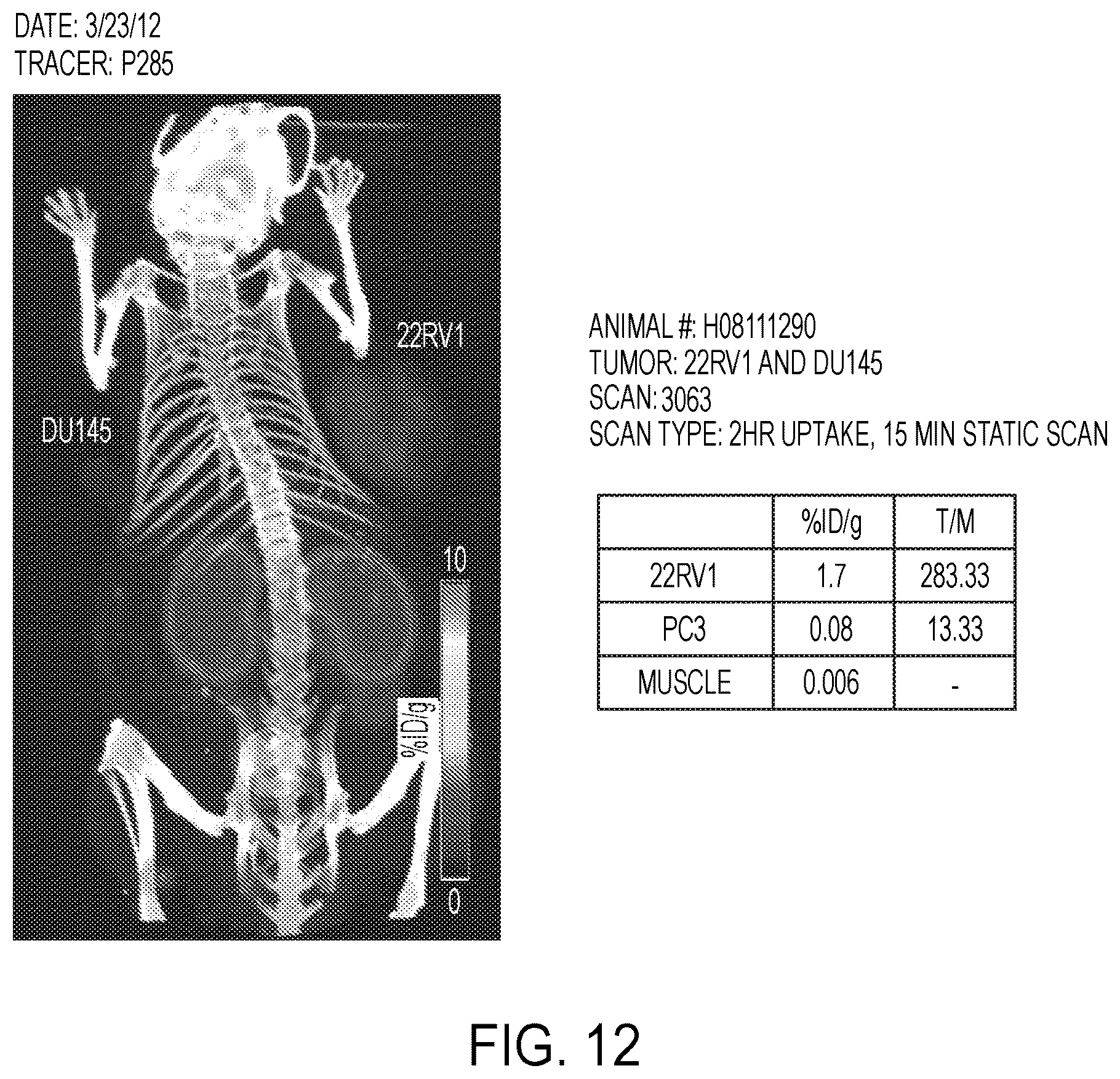 Patent US12583887 Figure 12 – PSMA imaging agents