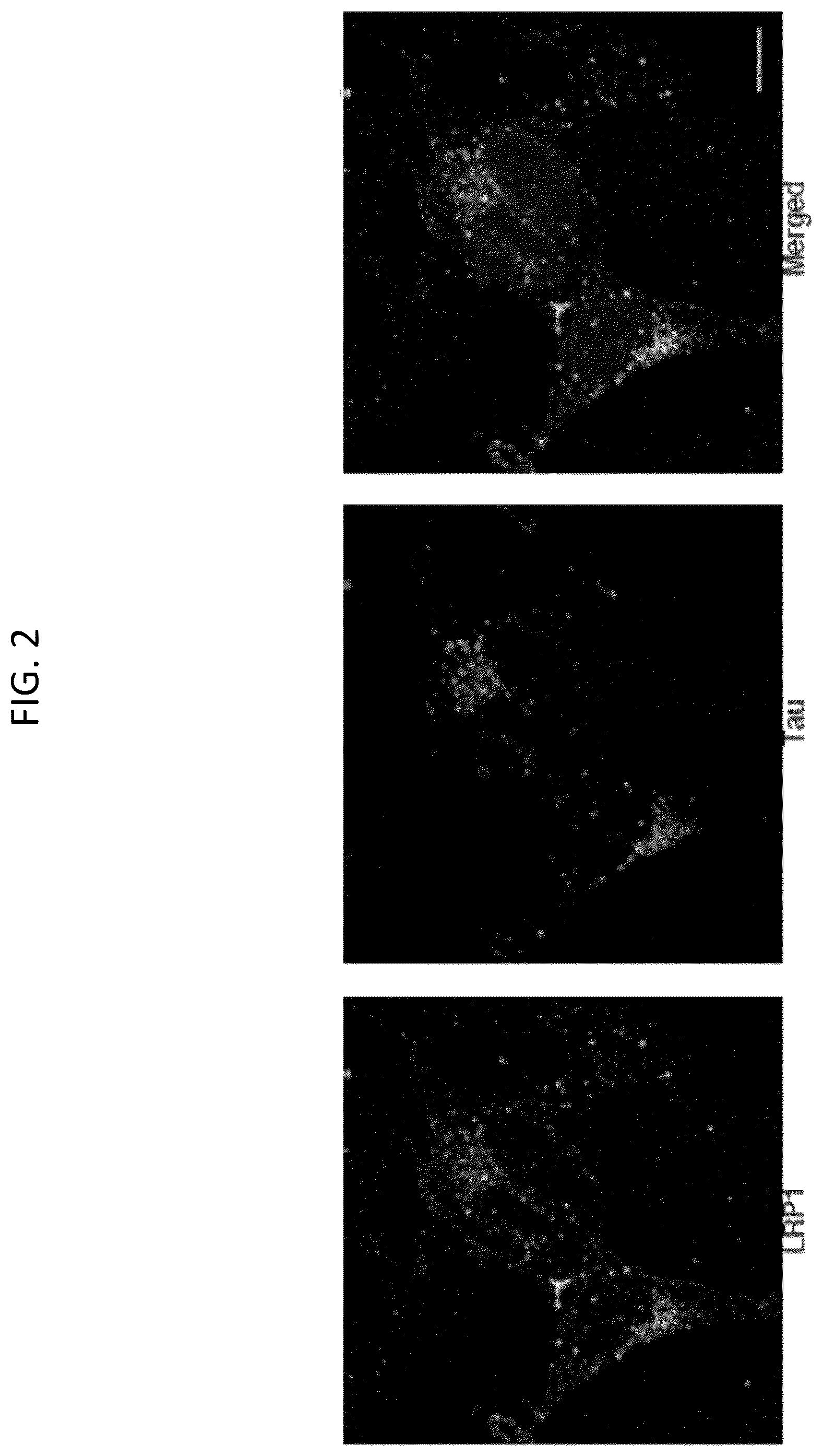 Patent US12583920 Figure 3 – Compositions and methods for treatment and prevention of Alzheimer's disease