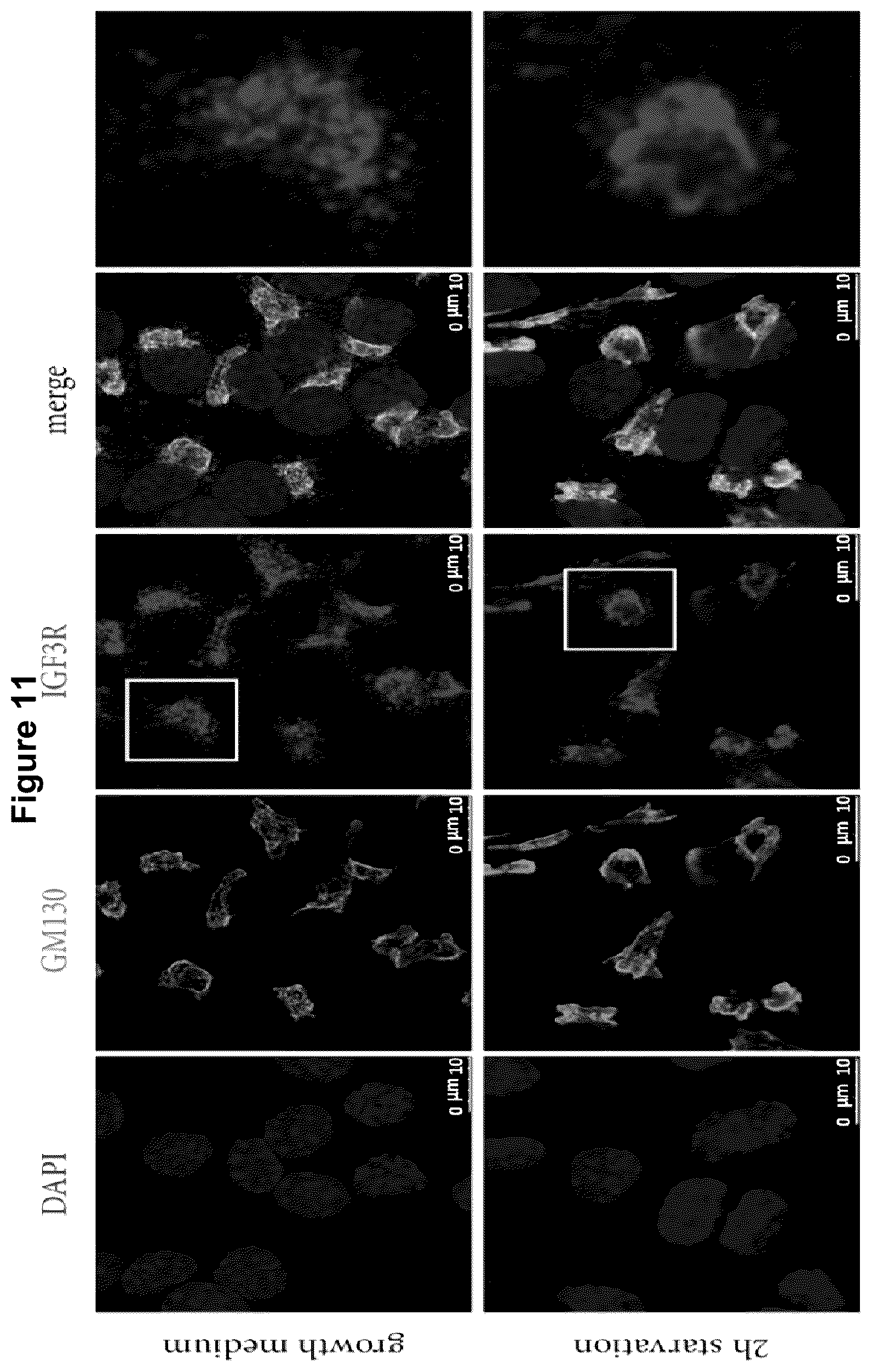 Patent US12583928 Figure 13 – Antibodies against IGFR-like receptor and uses thereof