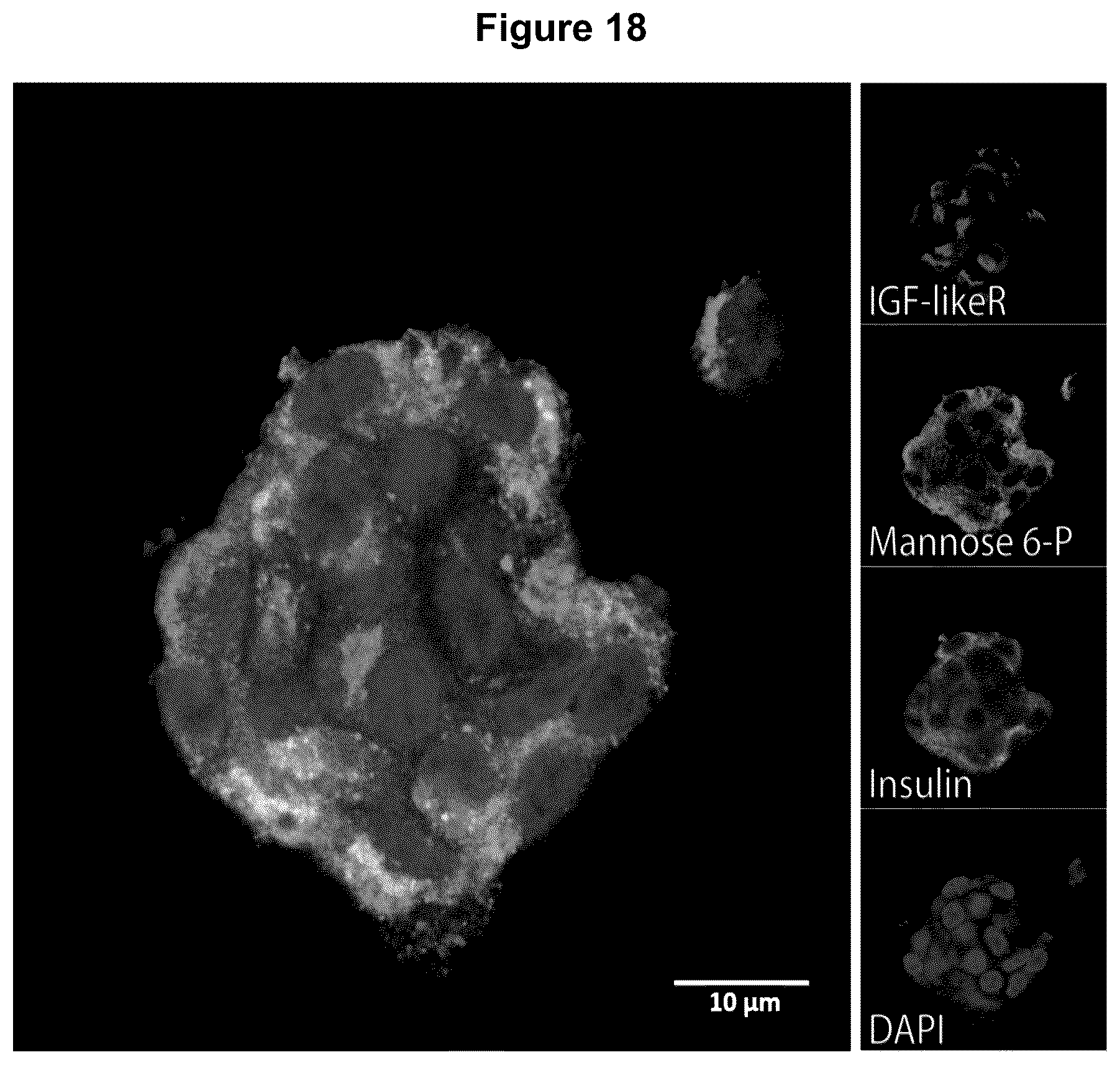 Patent US12583928 Figure 20 – Antibodies against IGFR-like receptor and uses thereof