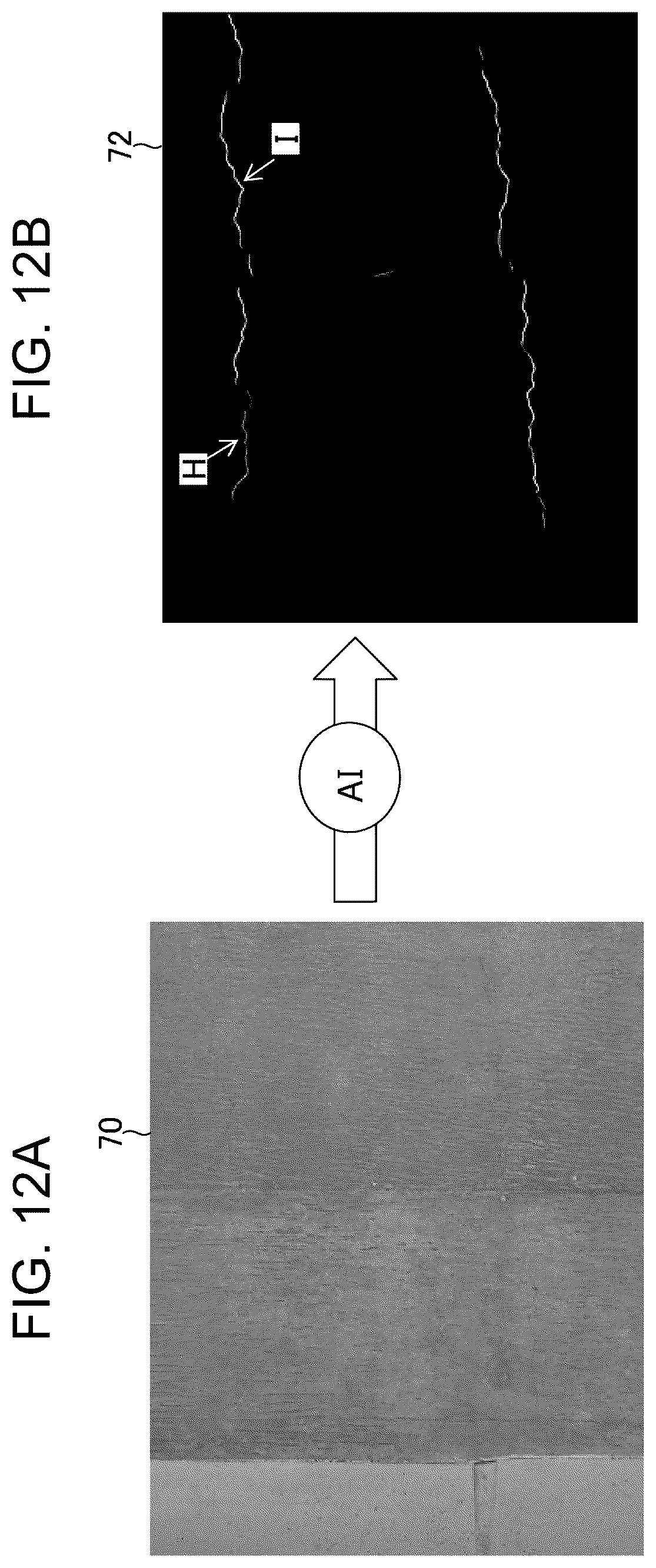 Patent US12586177 Figure 11 – Damage information processing device, damage information processing method, and program