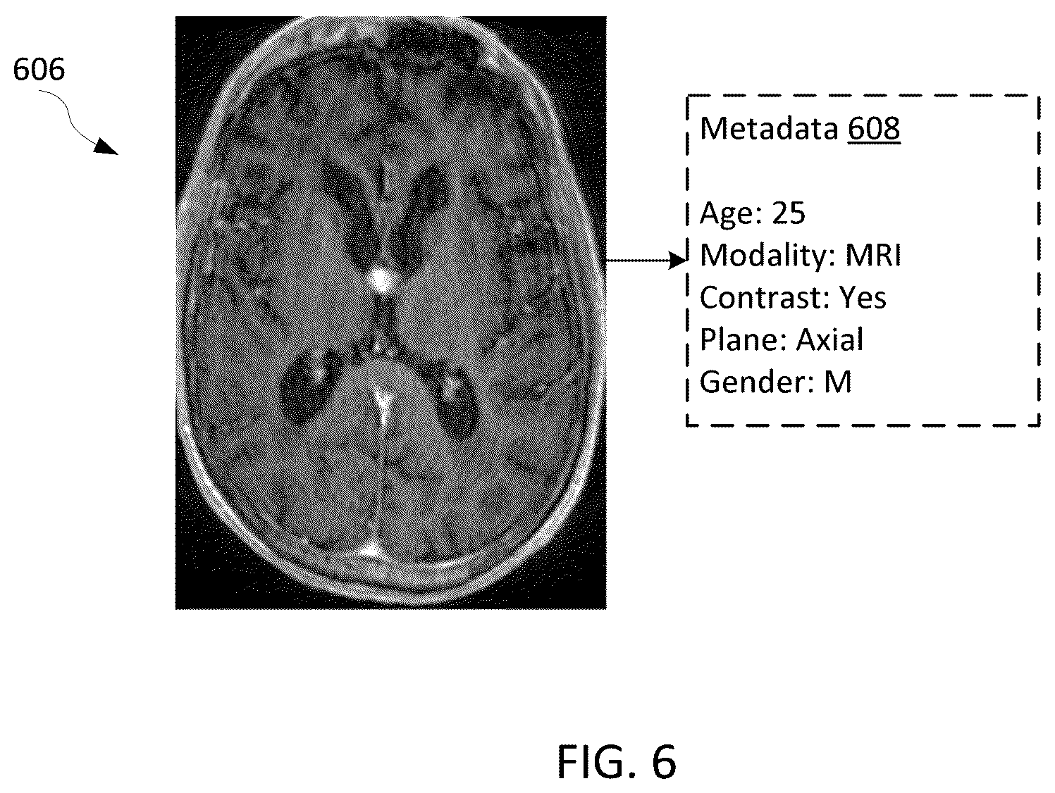 Patent US12586179 Figure 5 – Physician-guided machine learning system for assessing medical images to facilitate locating of a historical twin
