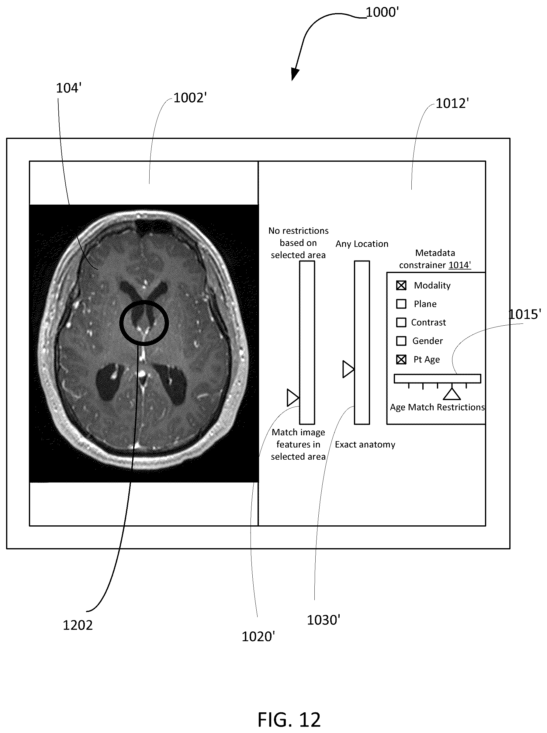 Patent US12586179 Figure 12 – Physician-guided machine learning system for assessing medical images to facilitate locating of a historical twin