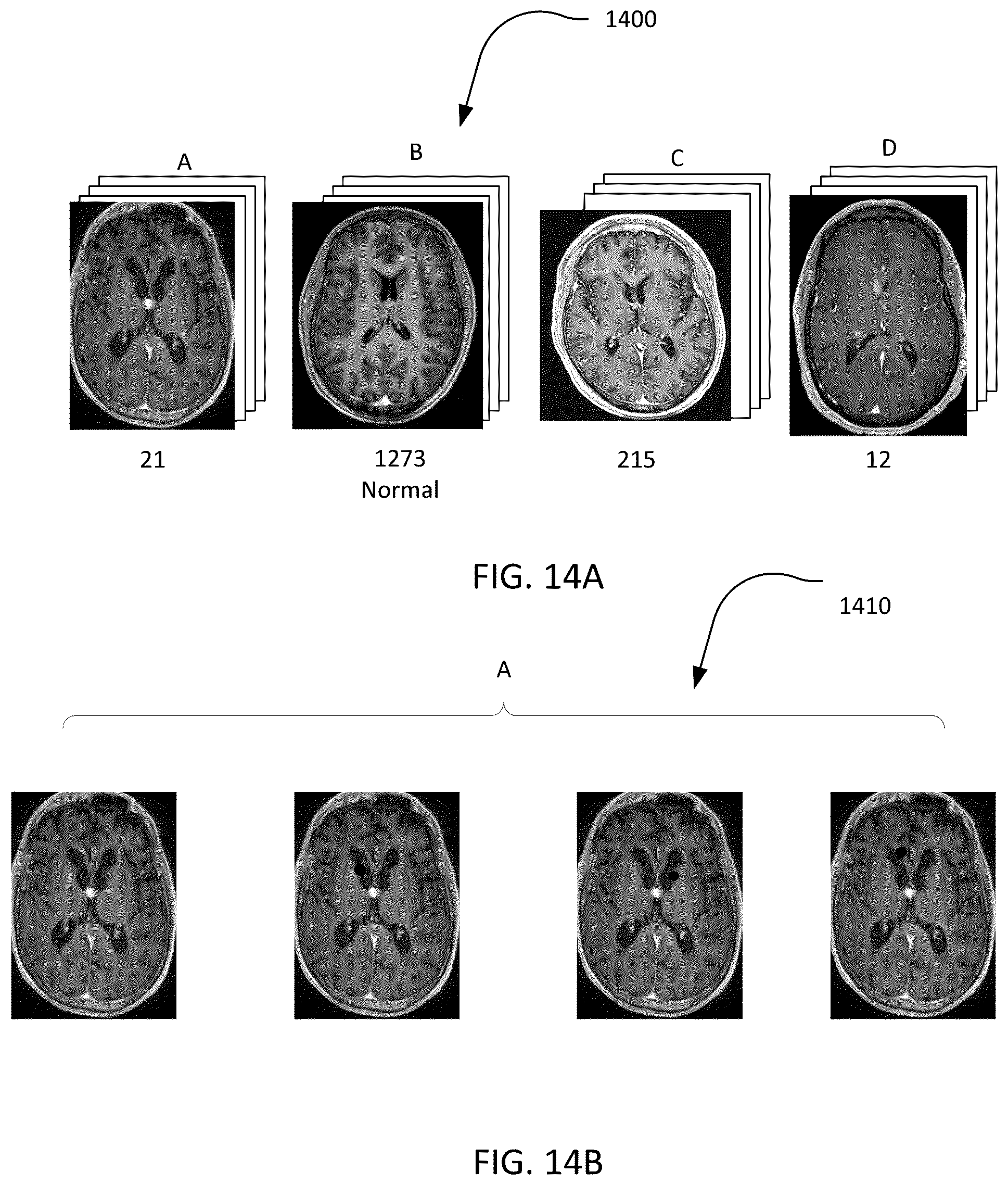 Patent US12586179 Figure 14 – Physician-guided machine learning system for assessing medical images to facilitate locating of a historical twin
