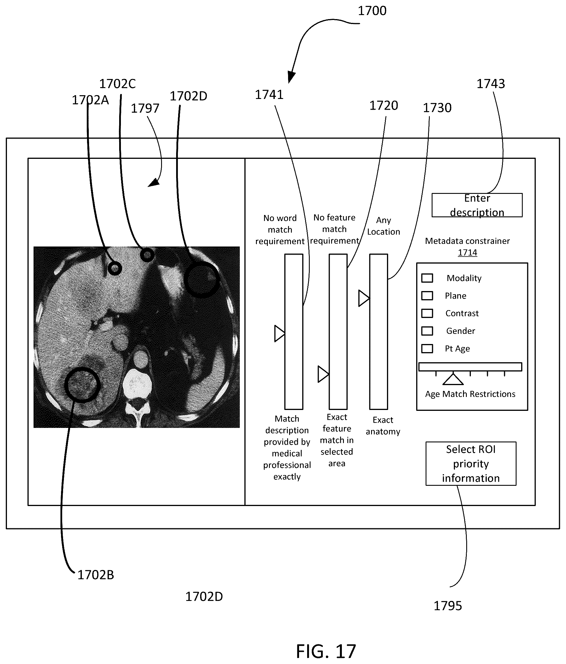 Patent US12586179 Figure 17 – Physician-guided machine learning system for assessing medical images to facilitate locating of a historical twin