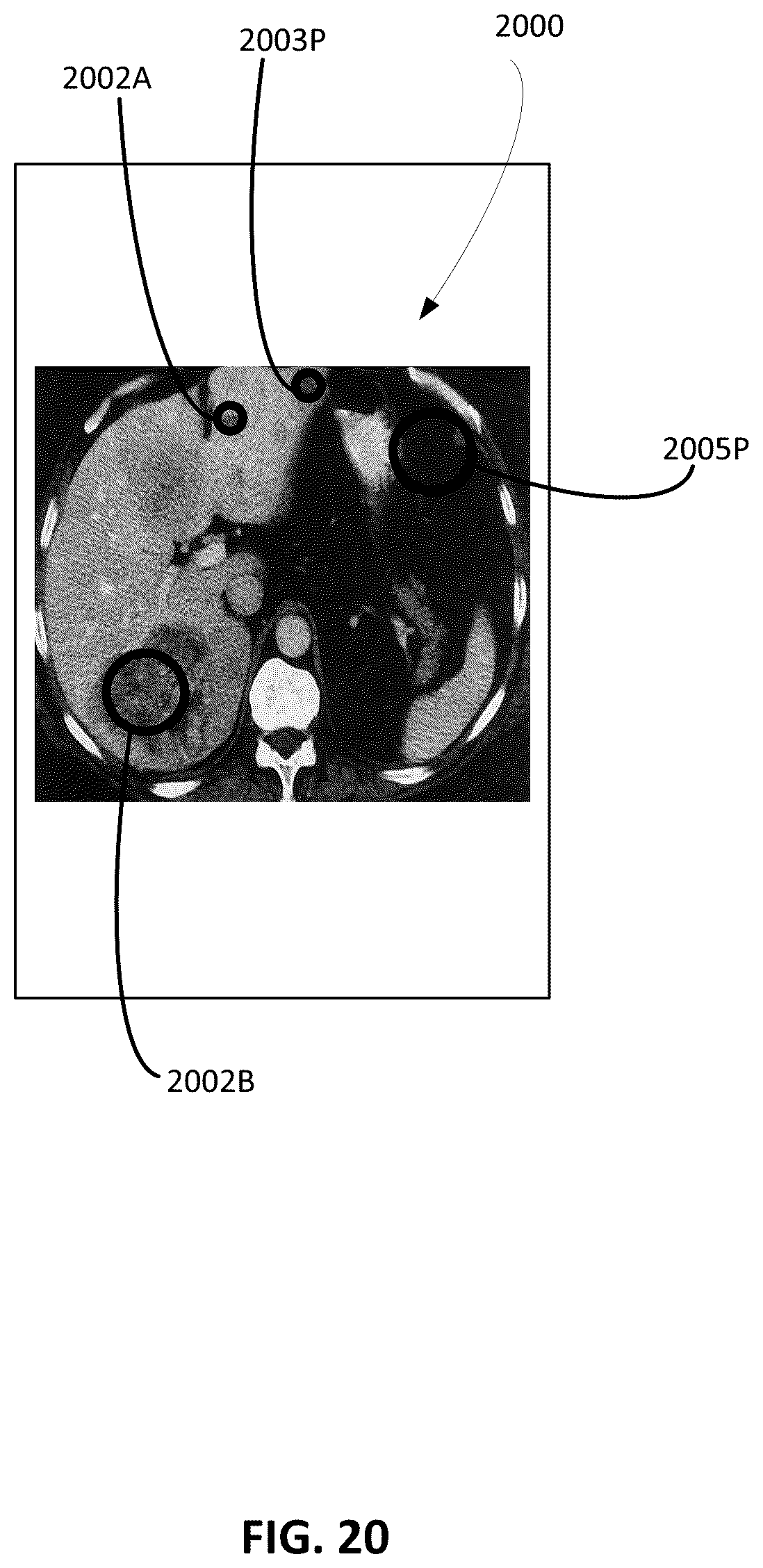 Patent US12586179 Figure 20 – Physician-guided machine learning system for assessing medical images to facilitate locating of a historical twin