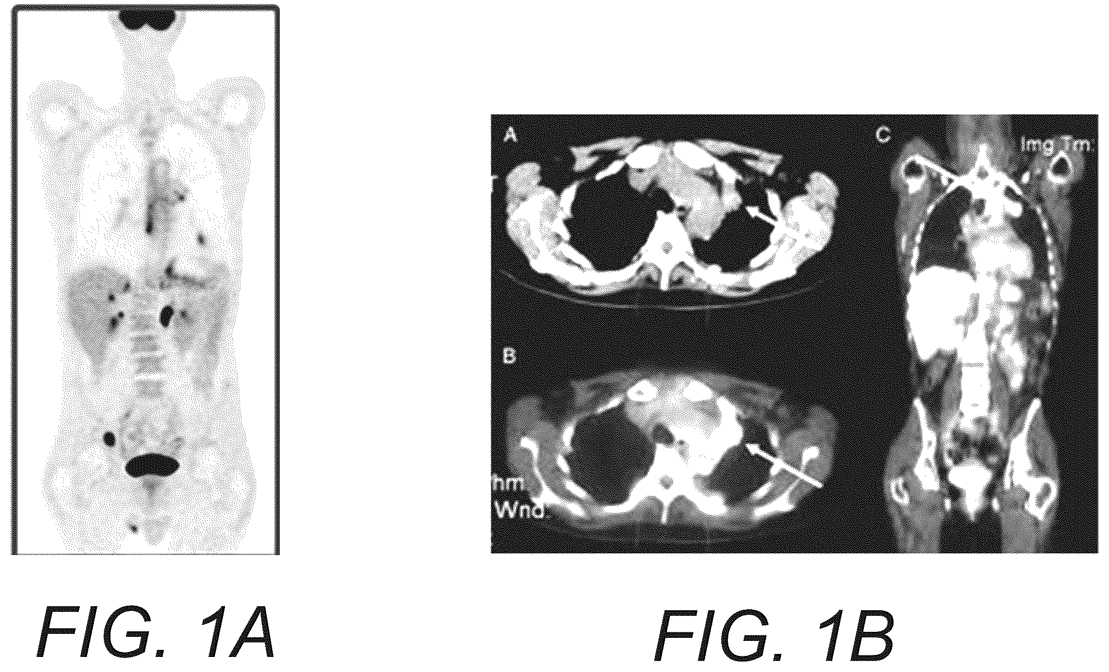 Patent US12586181 Figure 1 – Functional imaging features from computed tomography images