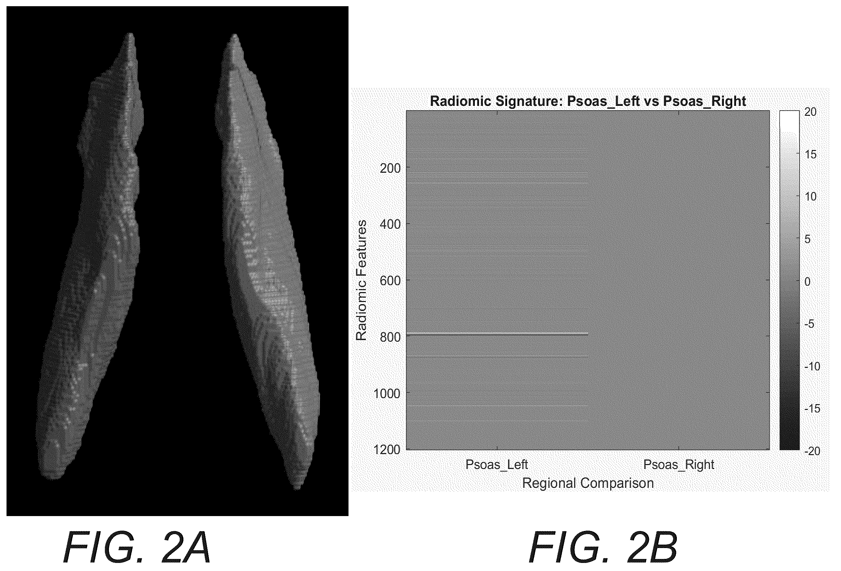 Patent US12586181 Figure 2 – Functional imaging features from computed tomography images