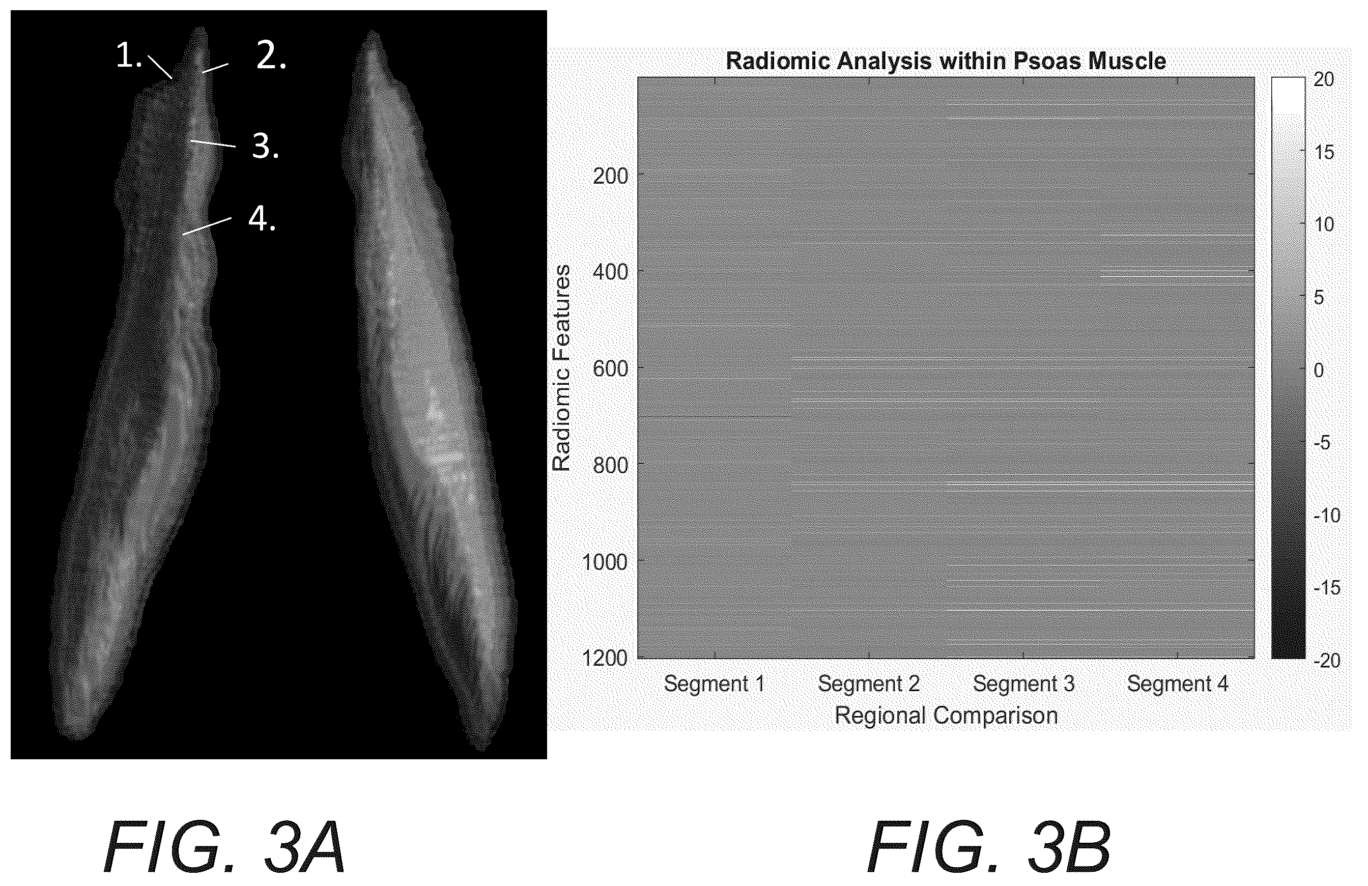 Patent US12586181 Figure 3 – Functional imaging features from computed tomography images