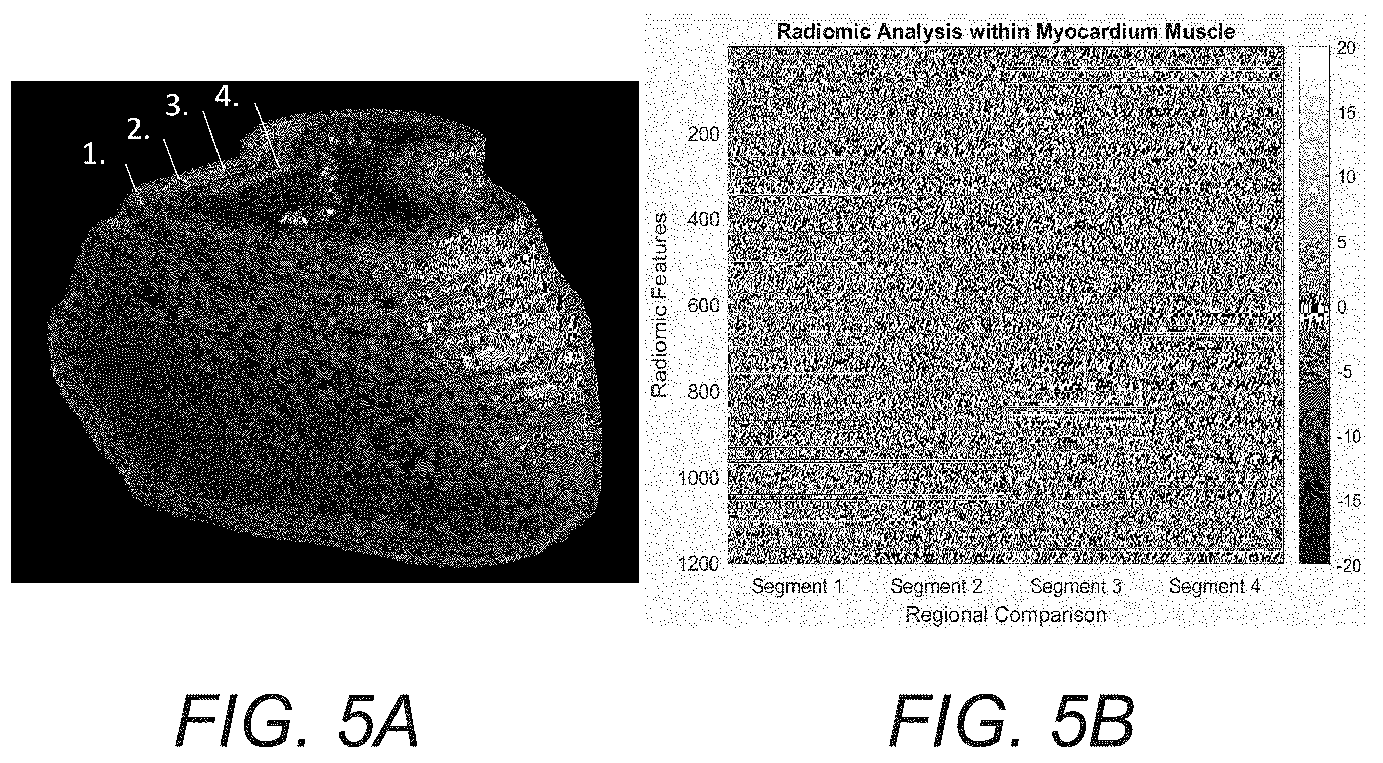 Patent US12586181 Figure 5 – Functional imaging features from computed tomography images