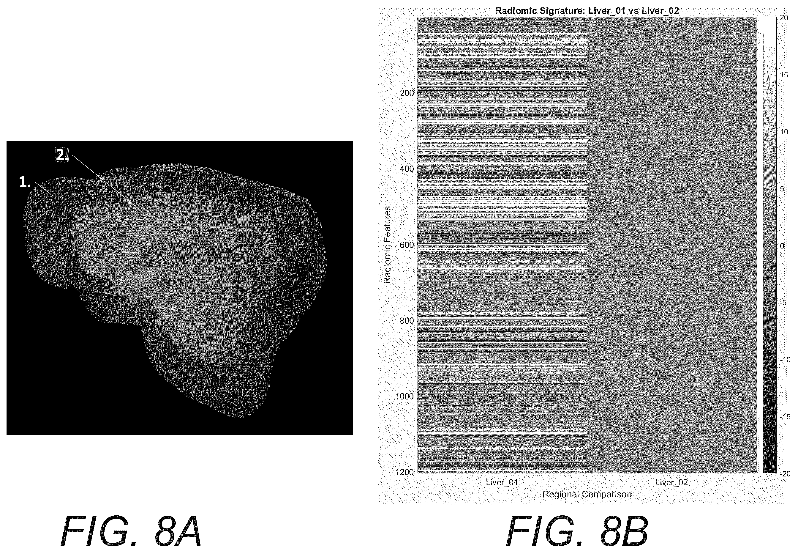 Patent US12586181 Figure 11 – Functional imaging features from computed tomography images