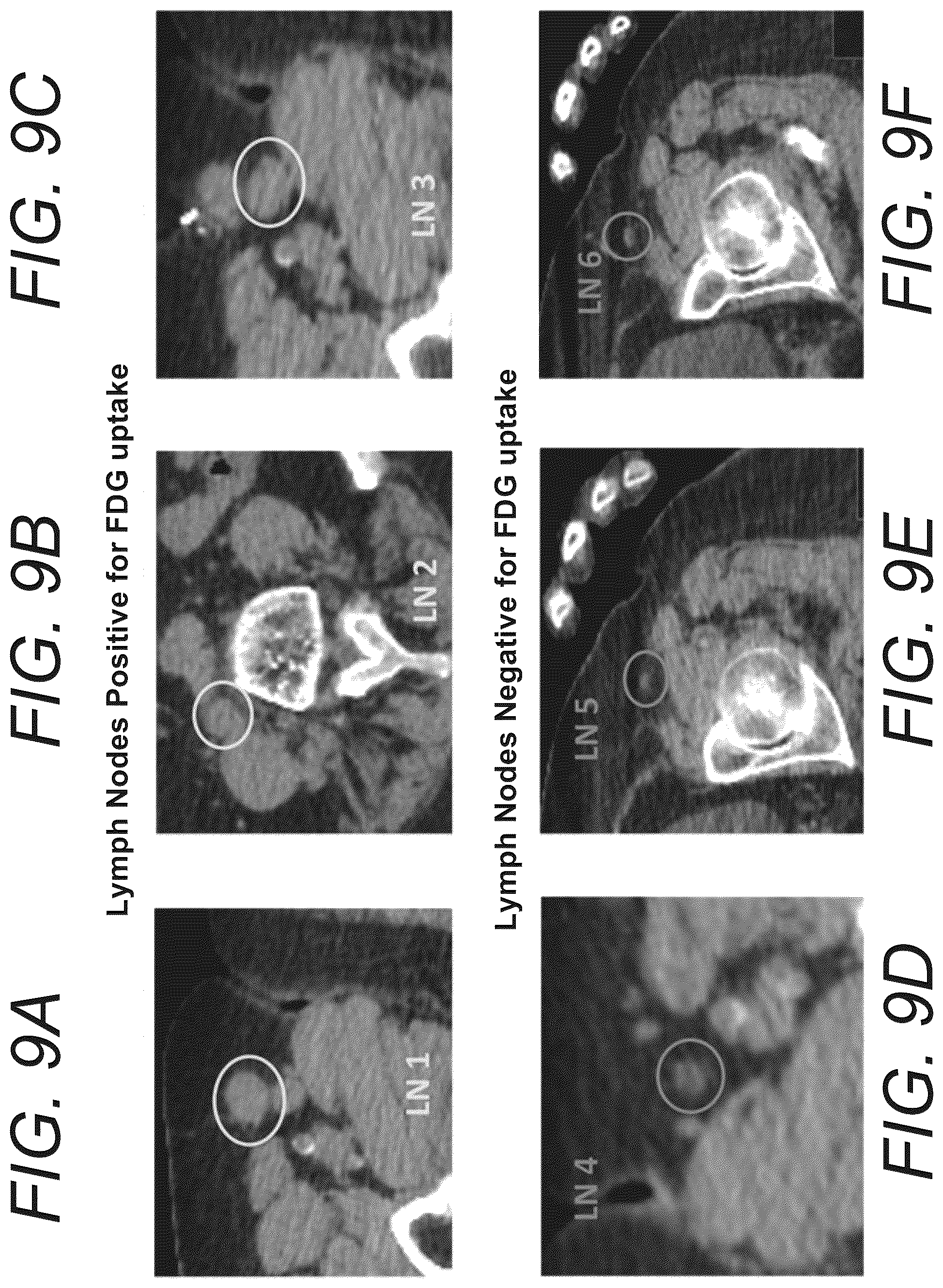 Patent US12586181 Figure 14 – Functional imaging features from computed tomography images