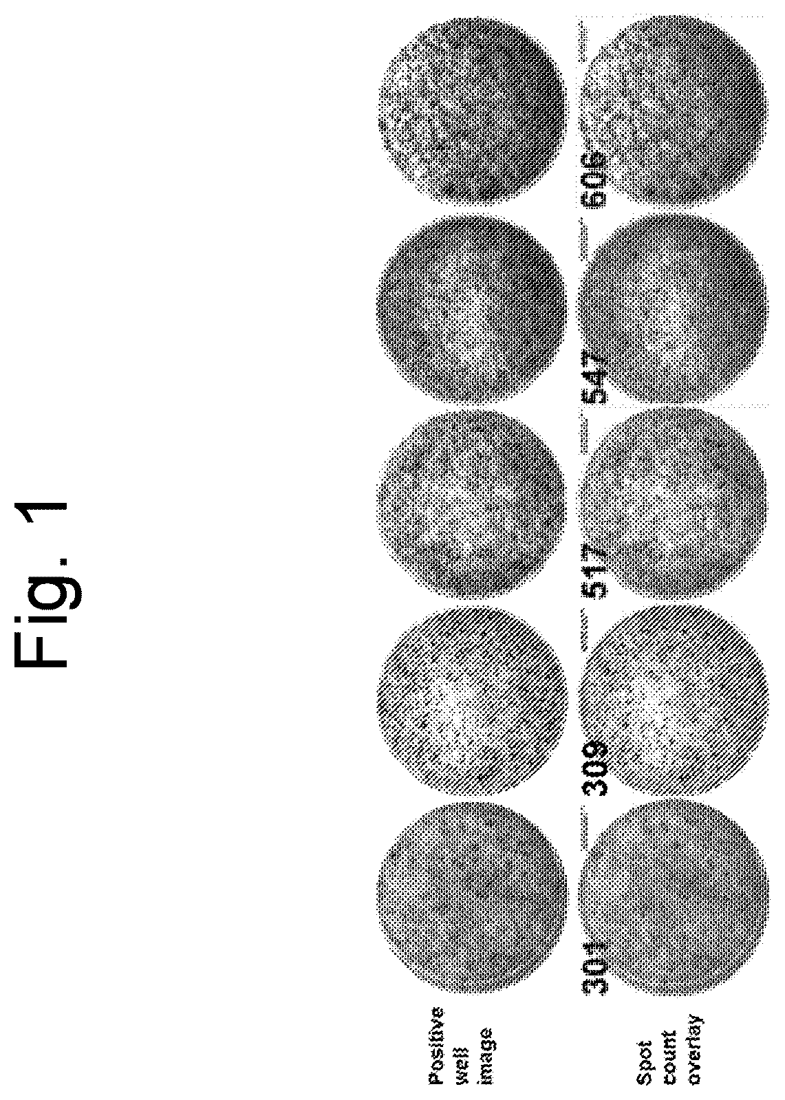 Patent US12586183 Figure 1 – Method for diagnosing latent tuberculosis infection