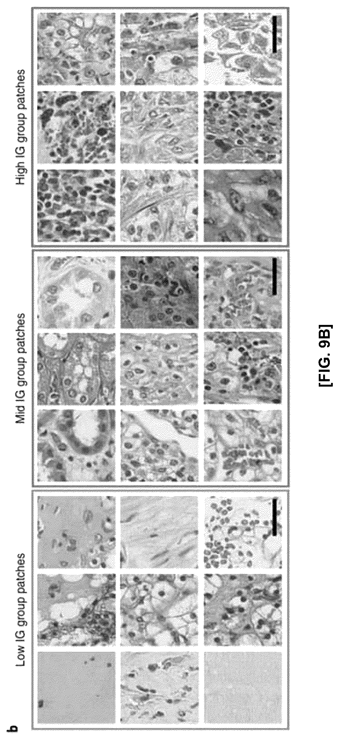 Patent US12586184 Figure 12 – Methods and apparatus for analyzing pathology patterns of whole-slide images based on graph deep learning