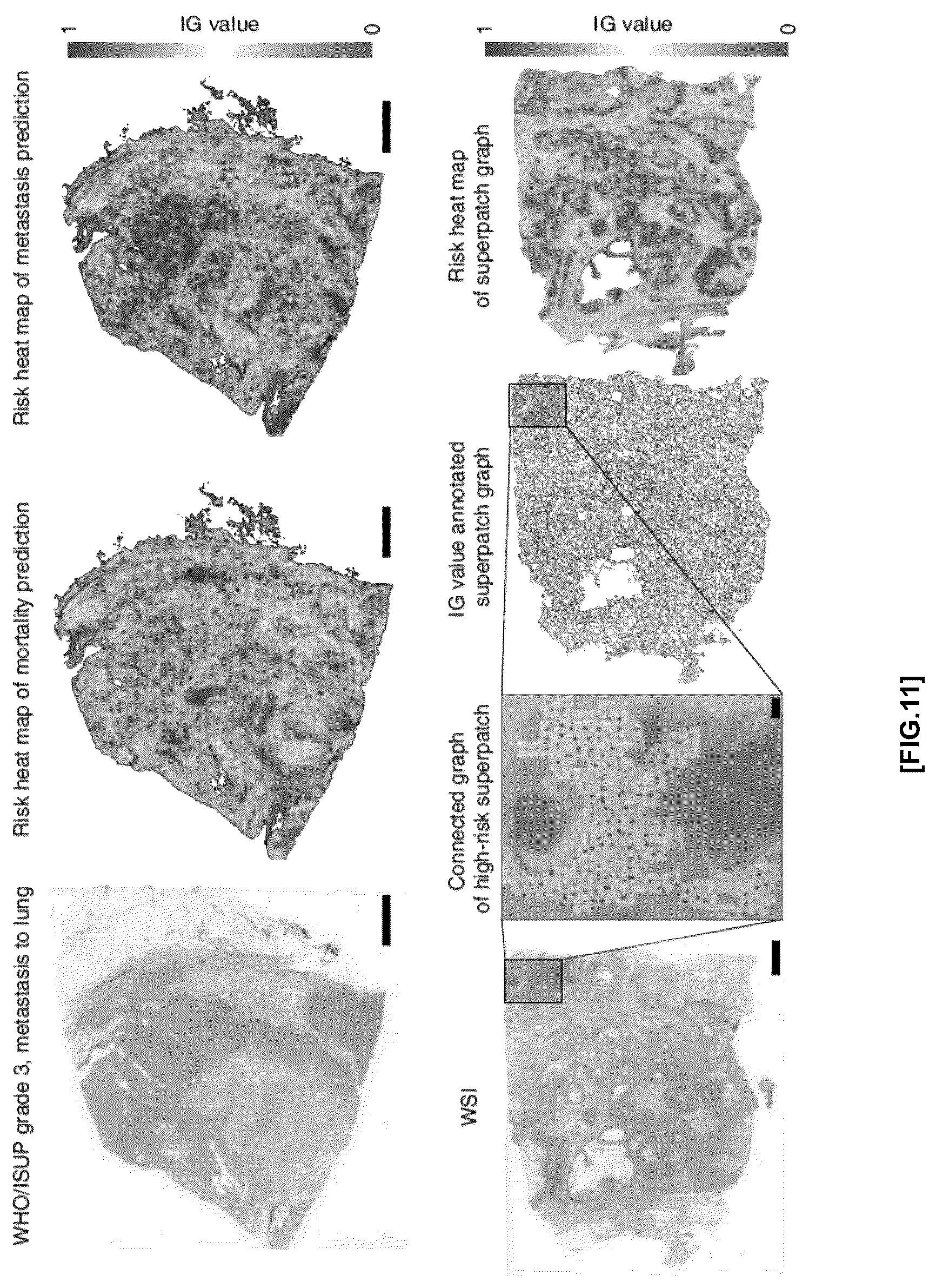 Patent US12586184 Figure 15 – Methods and apparatus for analyzing pathology patterns of whole-slide images based on graph deep learning