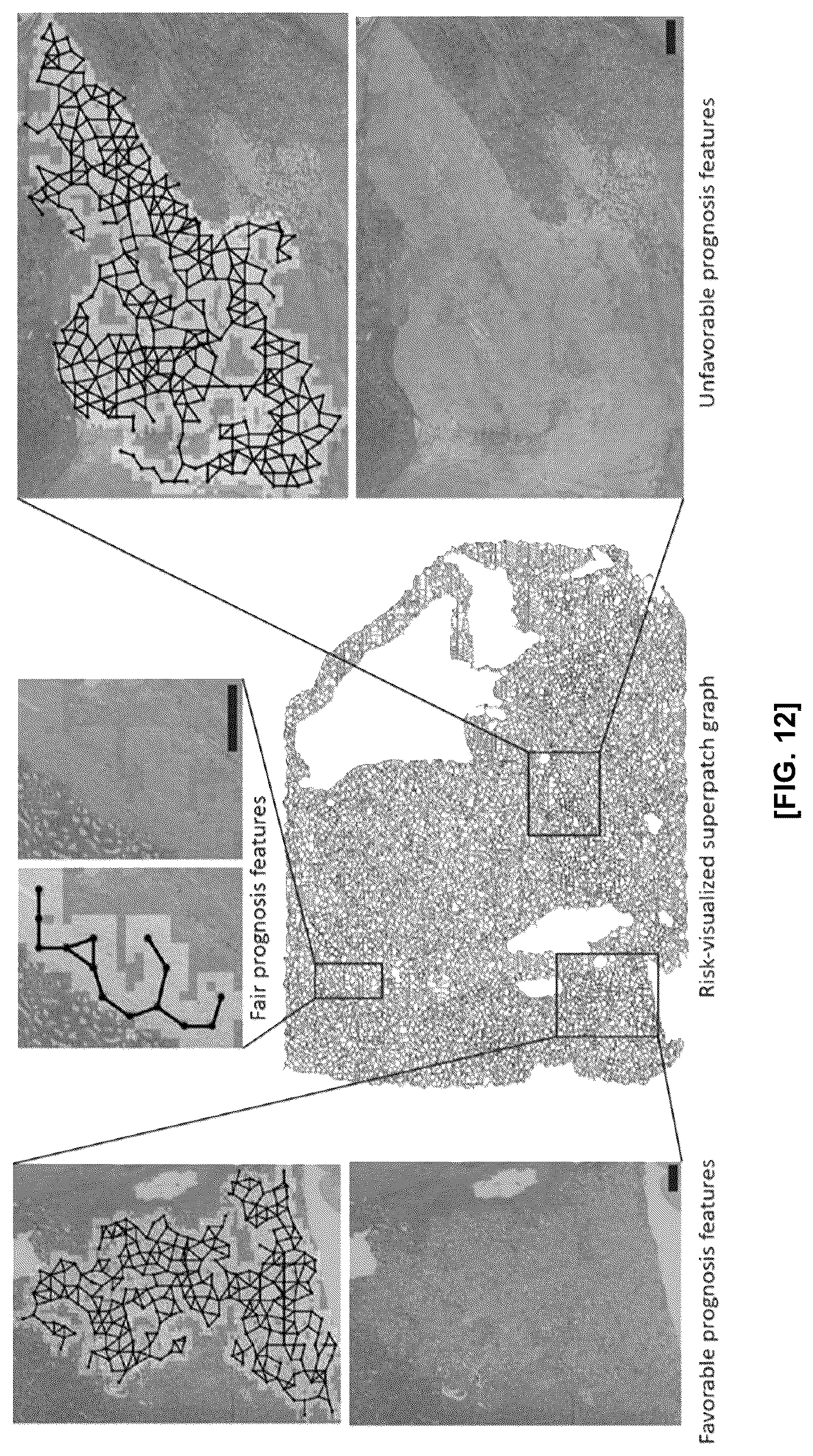 Patent US12586184 Figure 16 – Methods and apparatus for analyzing pathology patterns of whole-slide images based on graph deep learning