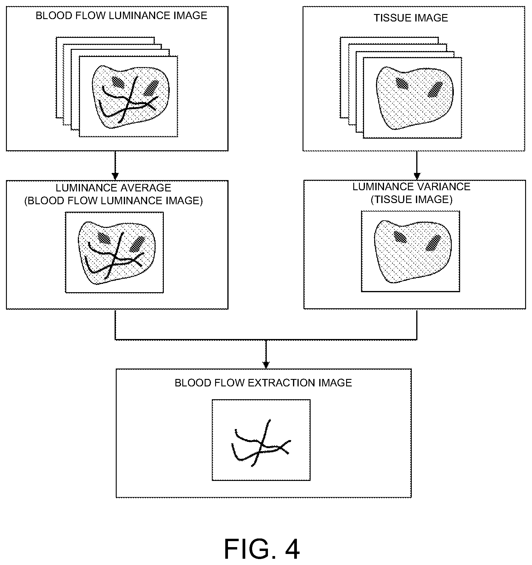 Patent US12586185 Figure 3 – Blood flow extraction image forming device, method of forming blood flow extraction image, and blood flow extraction image forming program