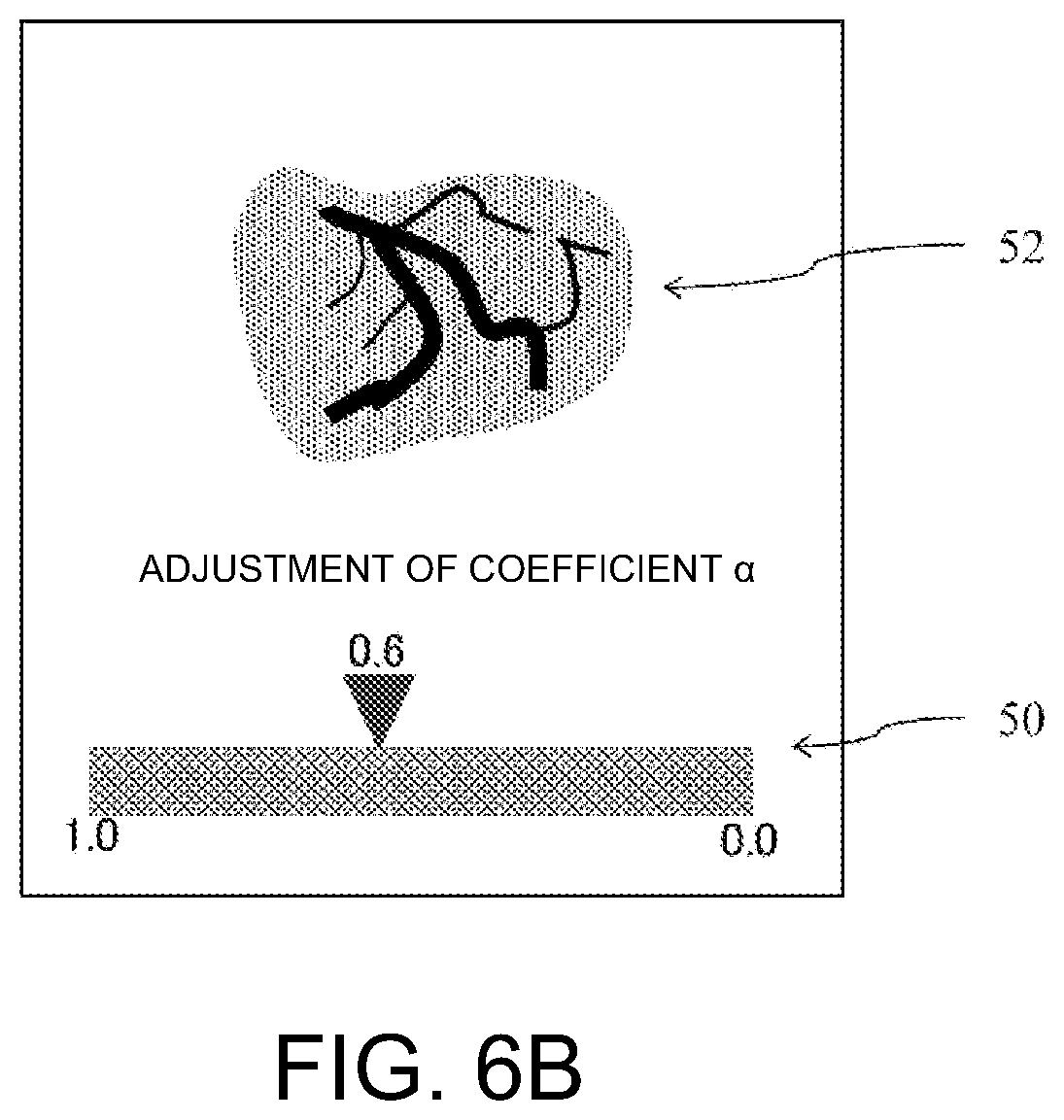 Patent US12586185 Figure 5 – Blood flow extraction image forming device, method of forming blood flow extraction image, and blood flow extraction image forming program
