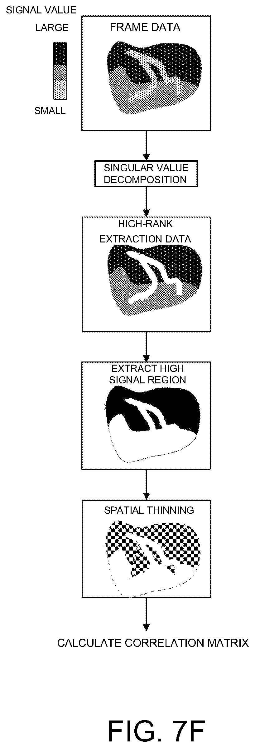 Patent US12586185 Figure 11 – Blood flow extraction image forming device, method of forming blood flow extraction image, and blood flow extraction image forming program