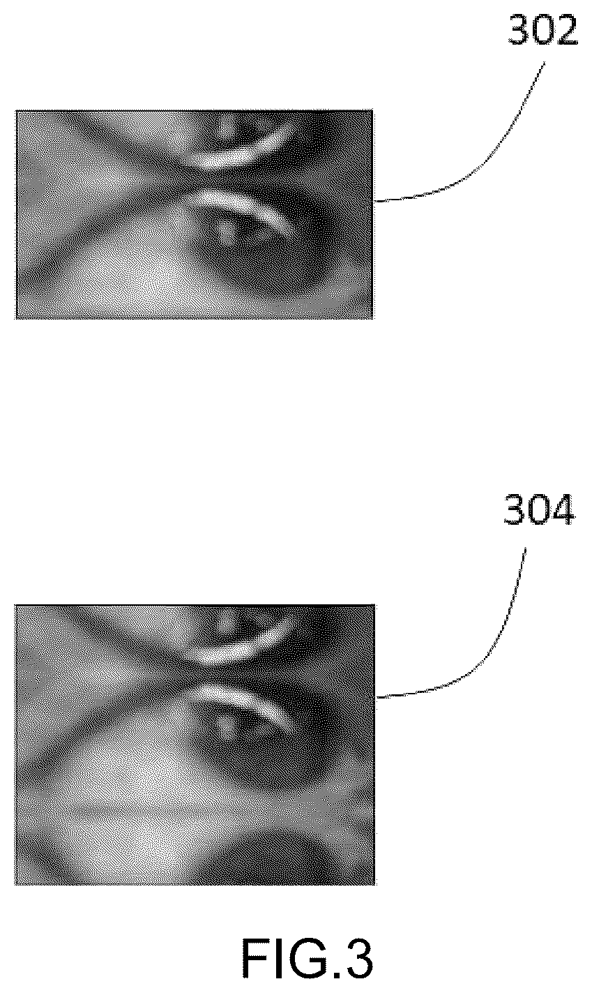 Patent US12586186 Figure 3 – Jaundice analysis system and method thereof