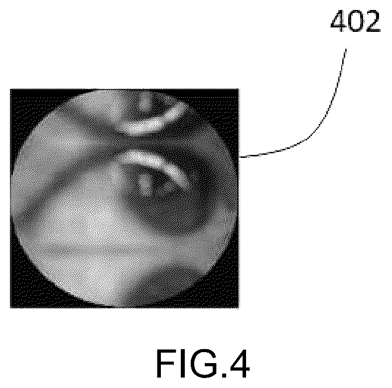 Patent US12586186 Figure 4 – Jaundice analysis system and method thereof