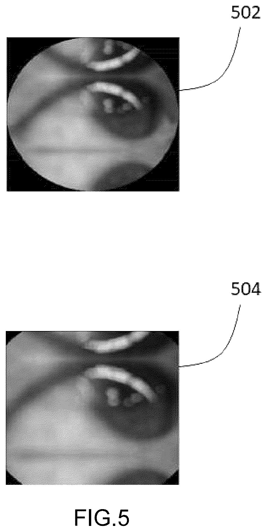 Patent US12586186 Figure 5 – Jaundice analysis system and method thereof