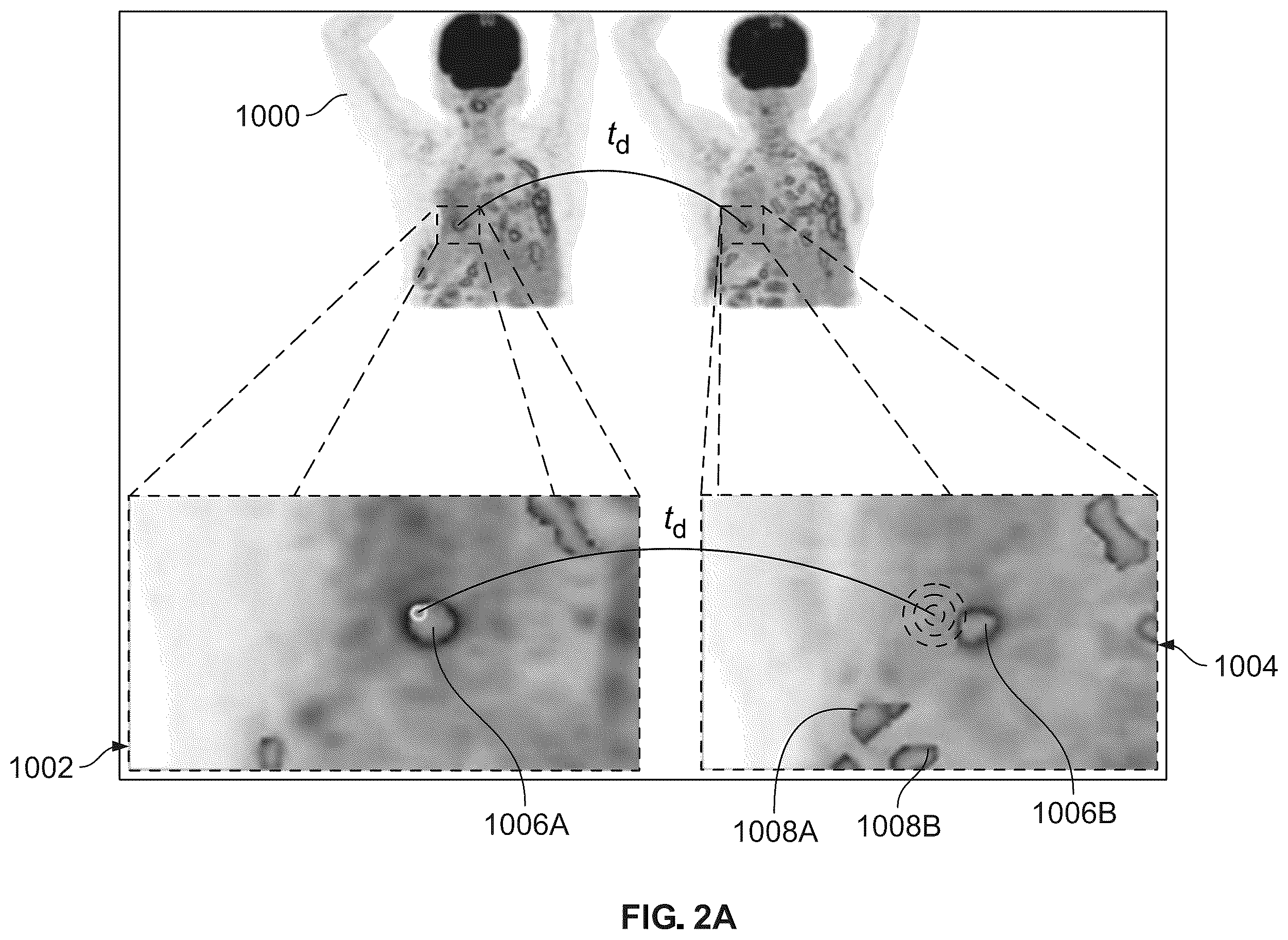 Patent US12586187 Figure 2 – Lesion linking using adaptive search and a system for implementing the same