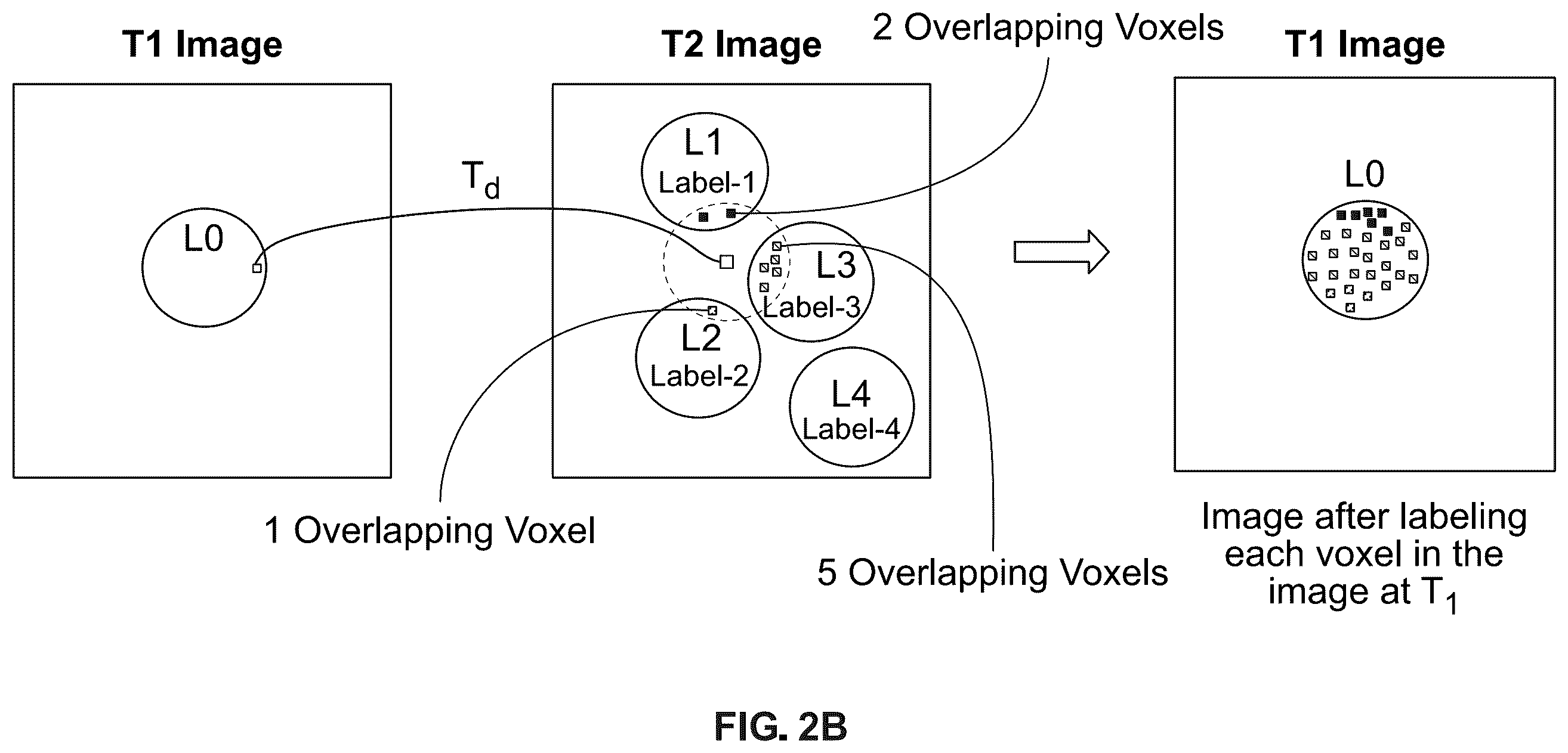 Patent US12586187 Figure 3 – Lesion linking using adaptive search and a system for implementing the same