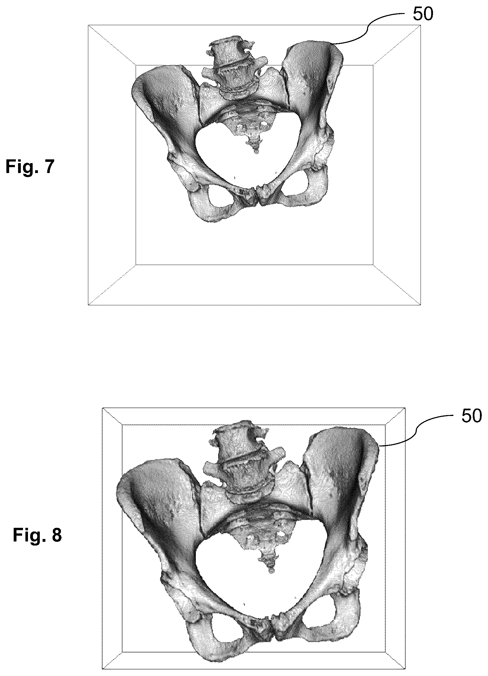 Patent US12586188 Figure 5 – Method and device for generating a three-dimensional synthetic image from a three-dimensional input image