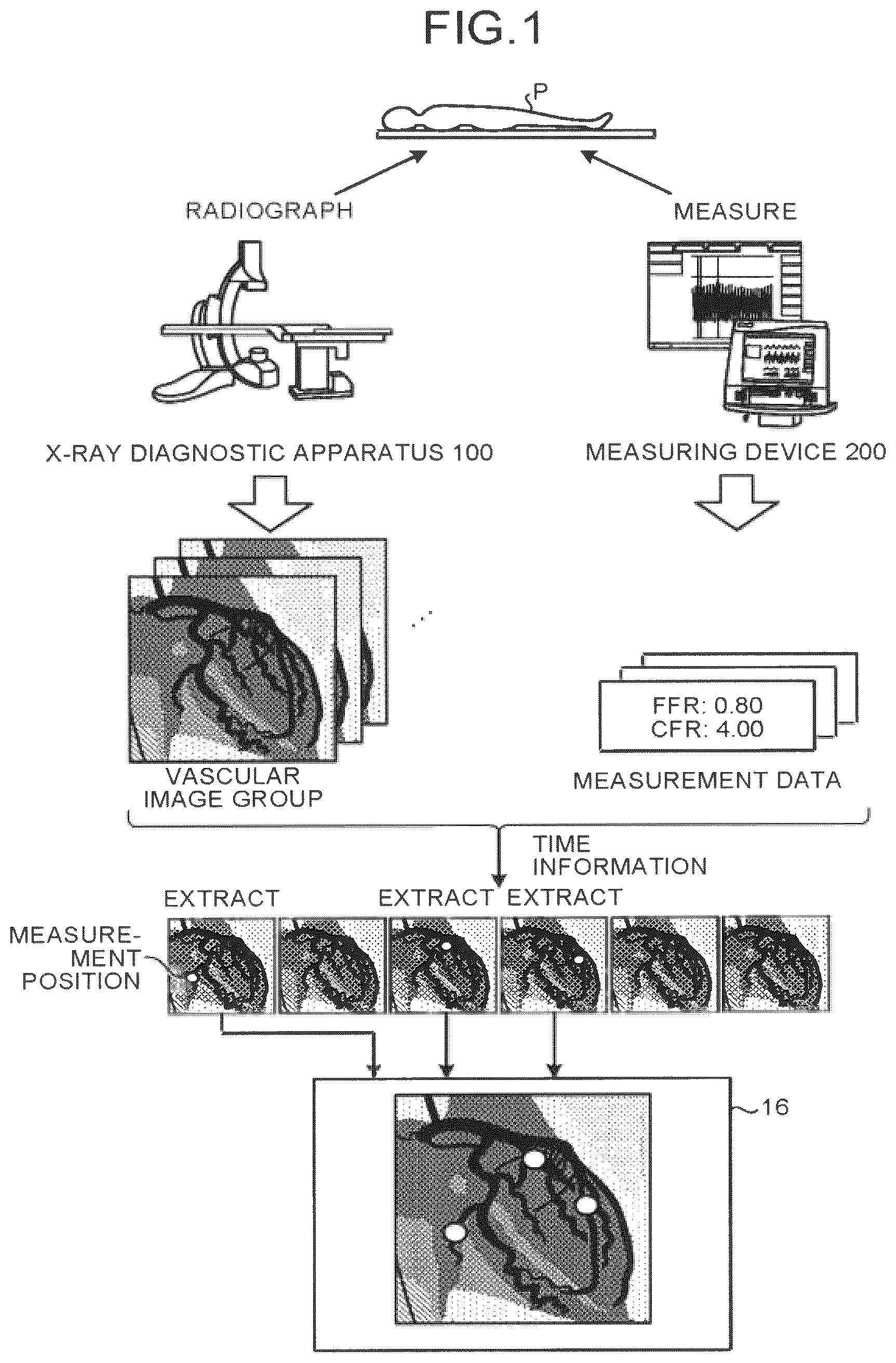 Patent US12586191 Figure 1 – Image processing apparatus, medical image diagnostic apparatus, and blood pressure monitor