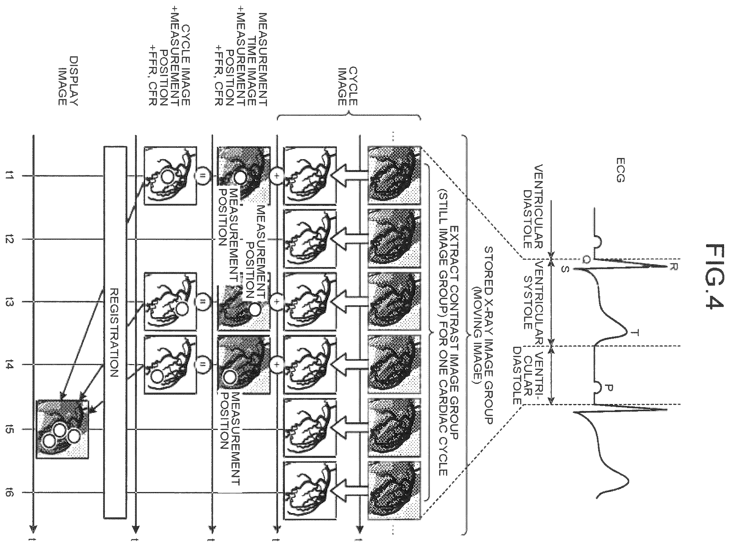 Patent US12586191 Figure 4 – Image processing apparatus, medical image diagnostic apparatus, and blood pressure monitor