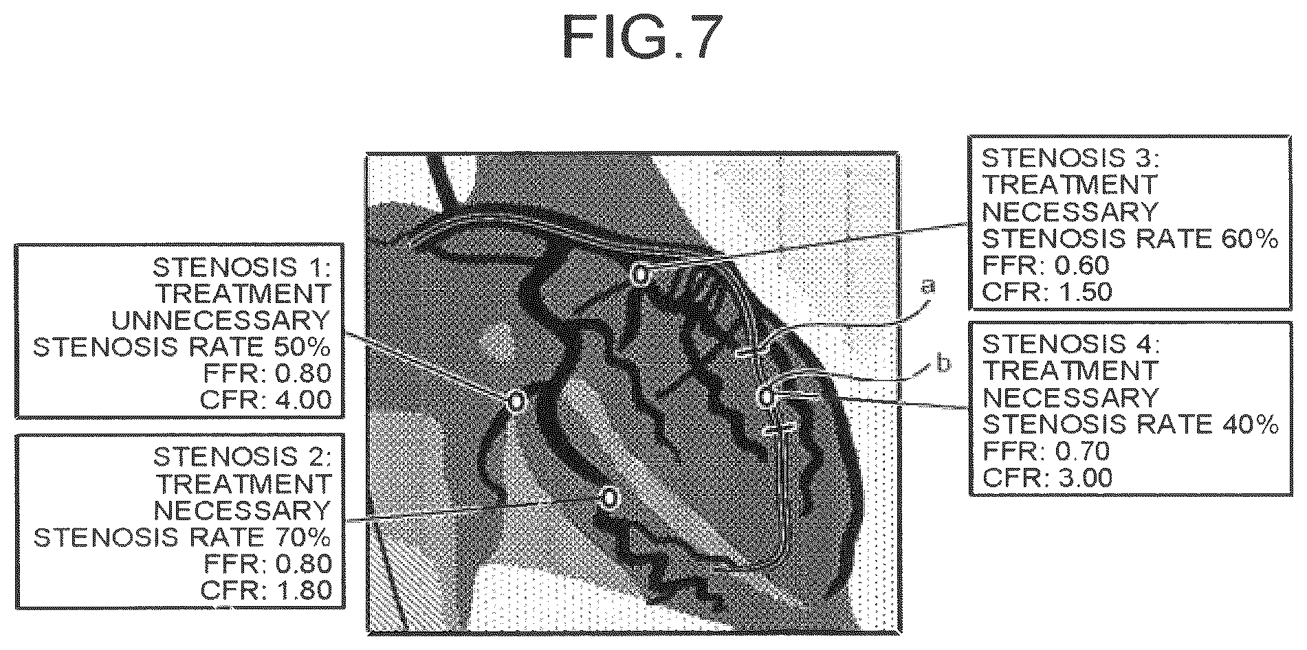Patent US12586191 Figure 6 – Image processing apparatus, medical image diagnostic apparatus, and blood pressure monitor