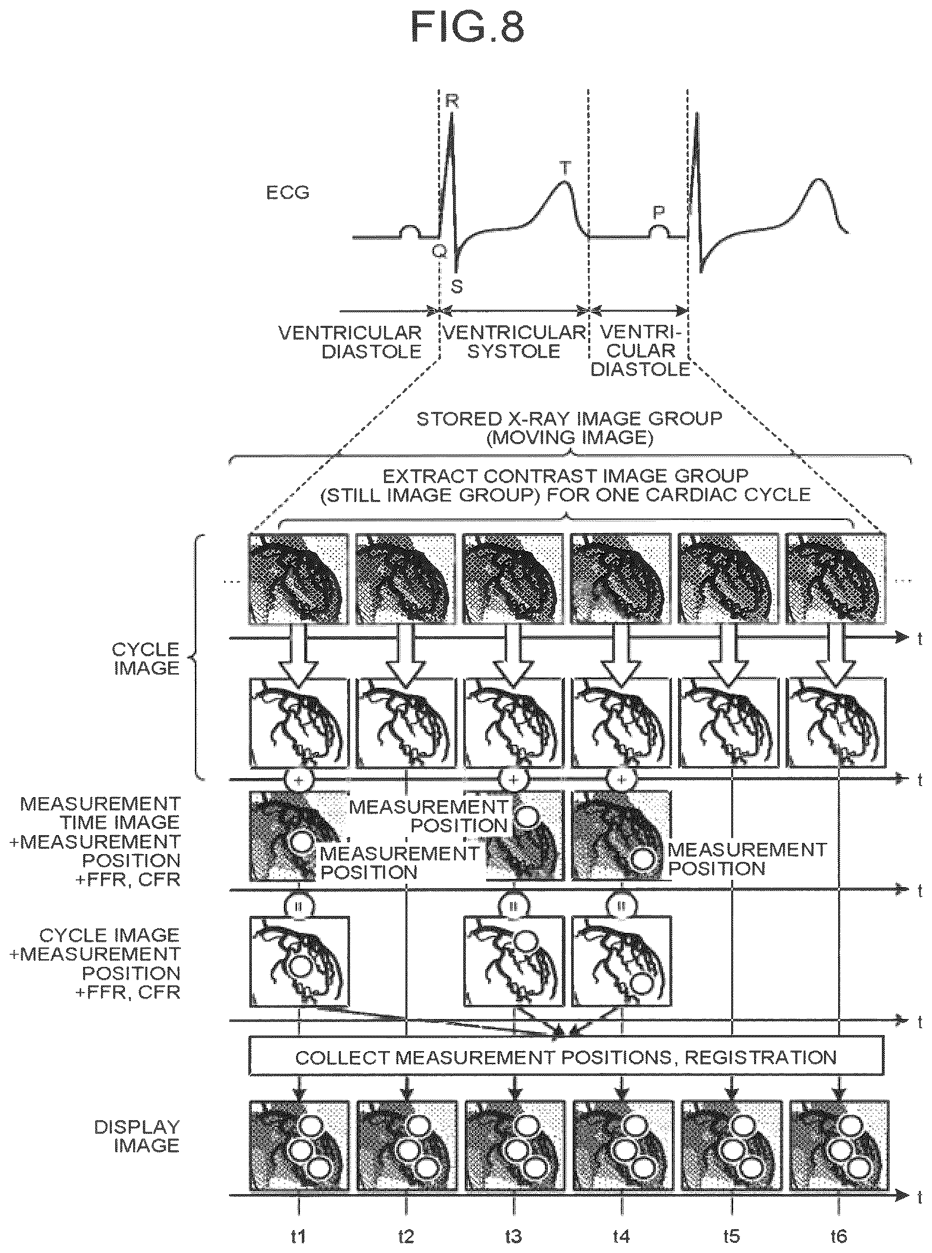 Patent US12586191 Figure 7 – Image processing apparatus, medical image diagnostic apparatus, and blood pressure monitor