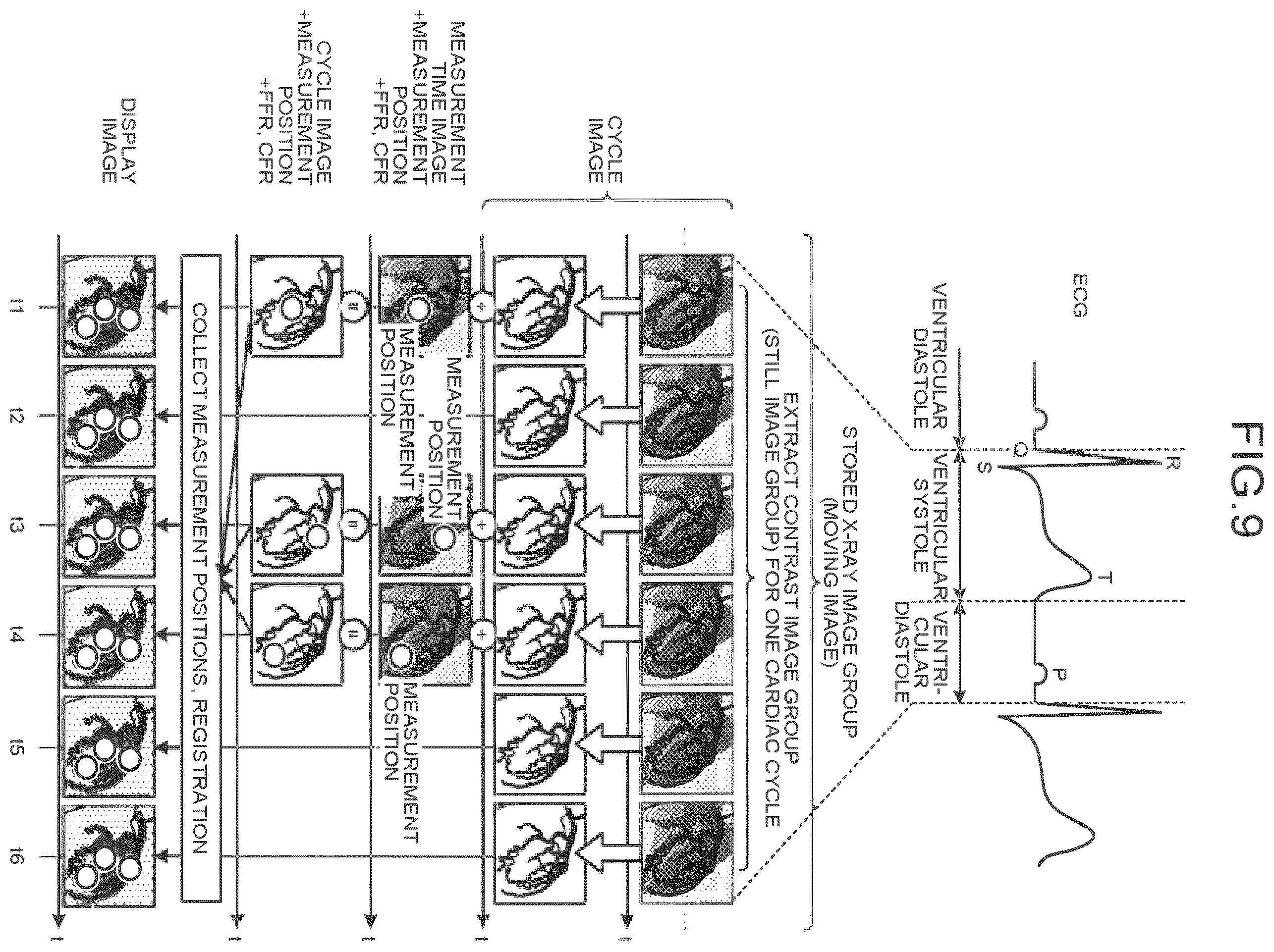 Patent US12586191 Figure 8 – Image processing apparatus, medical image diagnostic apparatus, and blood pressure monitor