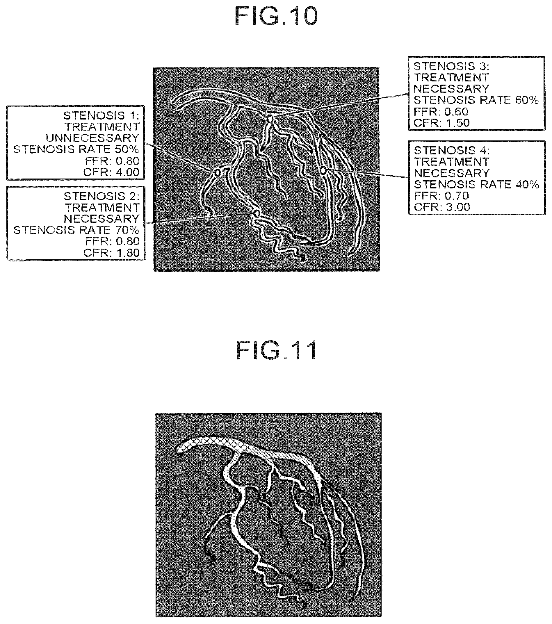 Patent US12586191 Figure 9 – Image processing apparatus, medical image diagnostic apparatus, and blood pressure monitor