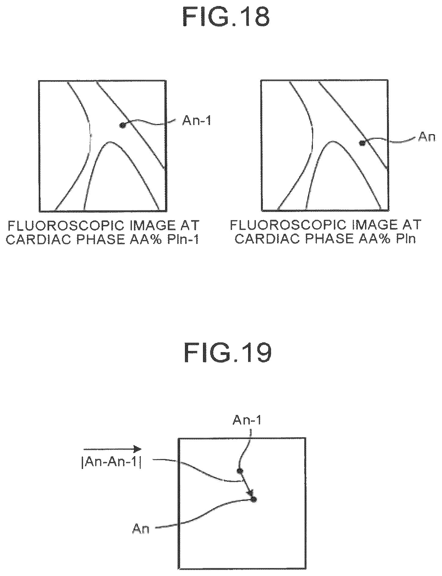 Patent US12586191 Figure 16 – Image processing apparatus, medical image diagnostic apparatus, and blood pressure monitor