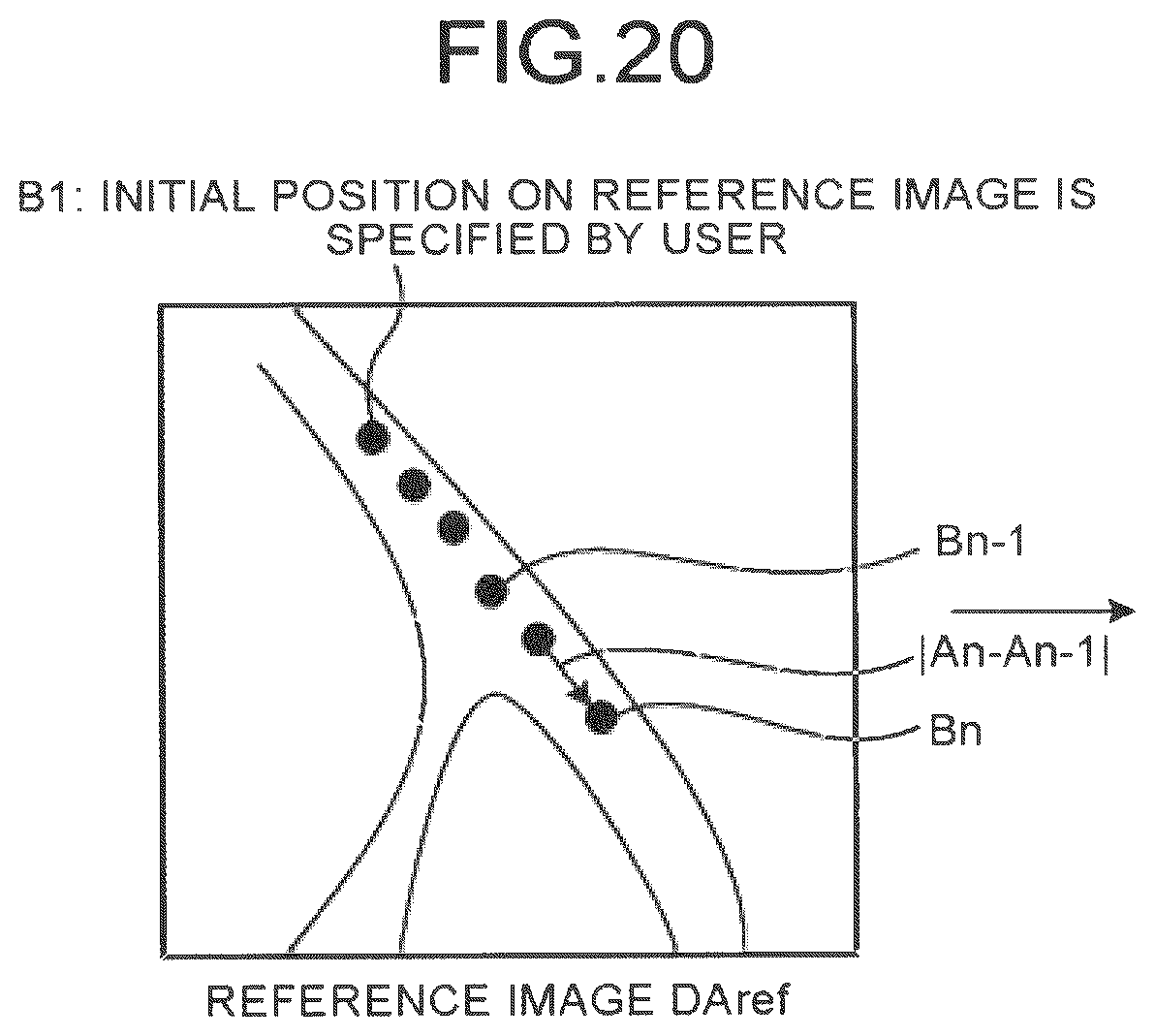 Patent US12586191 Figure 17 – Image processing apparatus, medical image diagnostic apparatus, and blood pressure monitor
