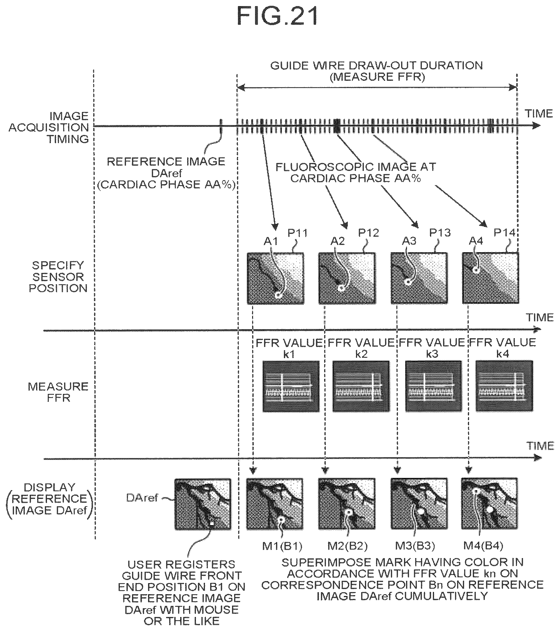 Patent US12586191 Figure 18 – Image processing apparatus, medical image diagnostic apparatus, and blood pressure monitor