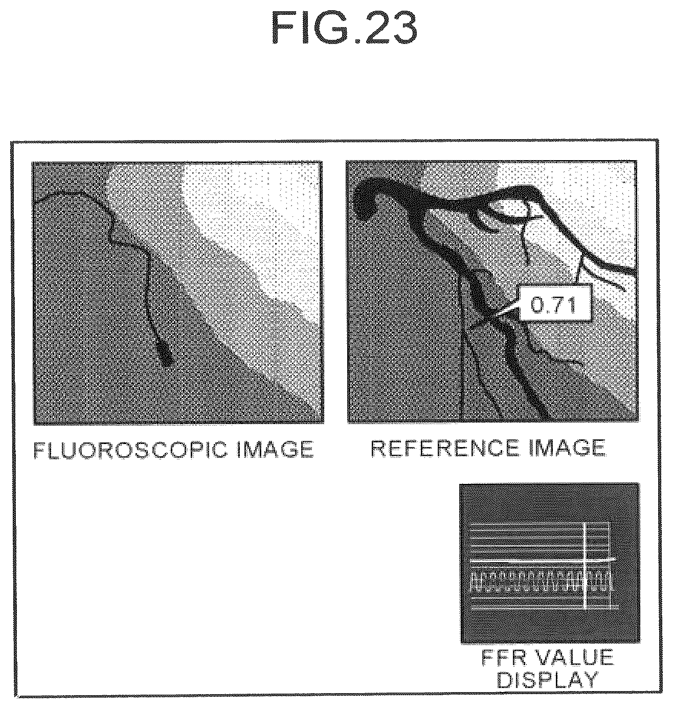 Patent US12586191 Figure 20 – Image processing apparatus, medical image diagnostic apparatus, and blood pressure monitor