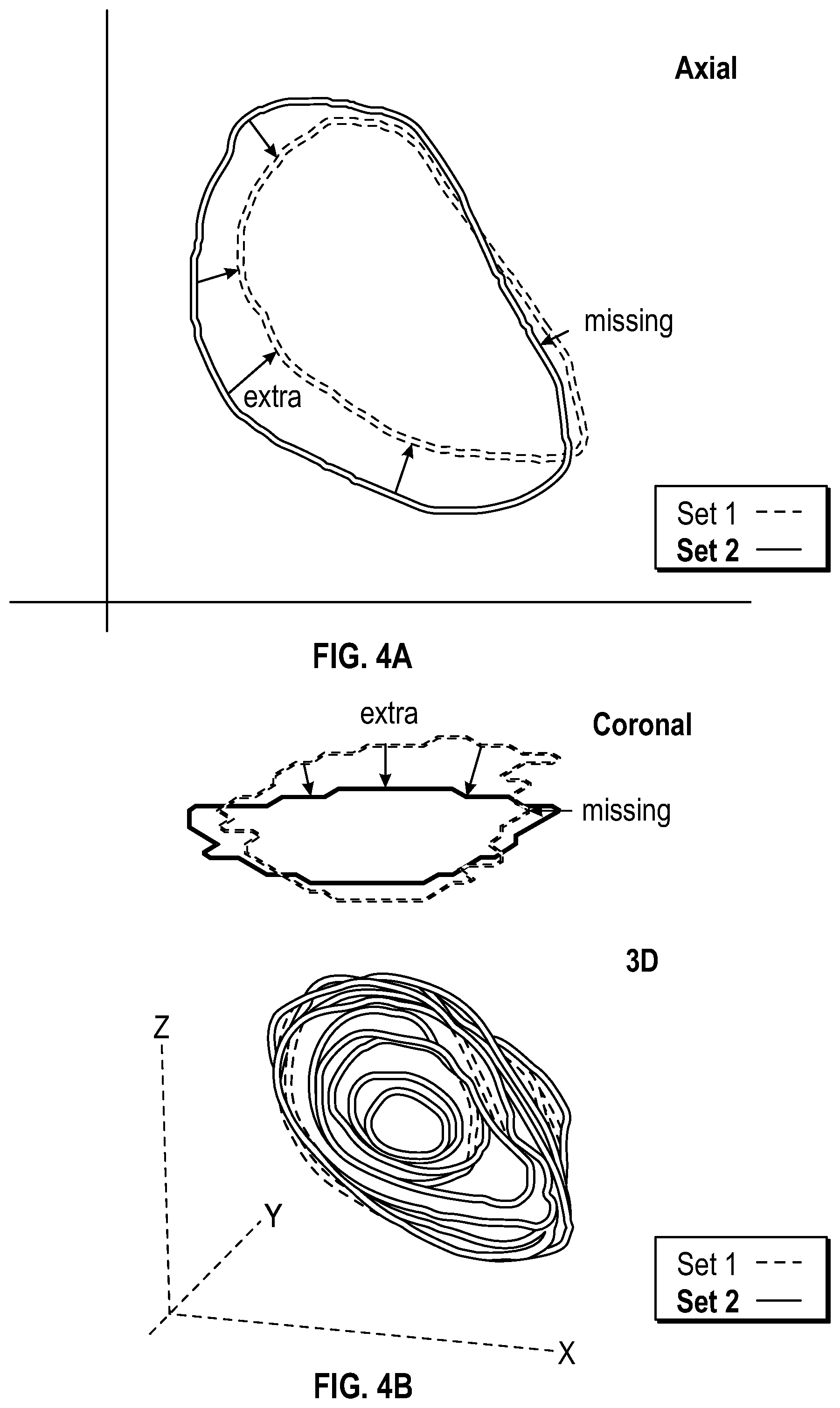 Patent US12586193 Figure 4 – Techniques for comparing image contours of different human participants using automated tool