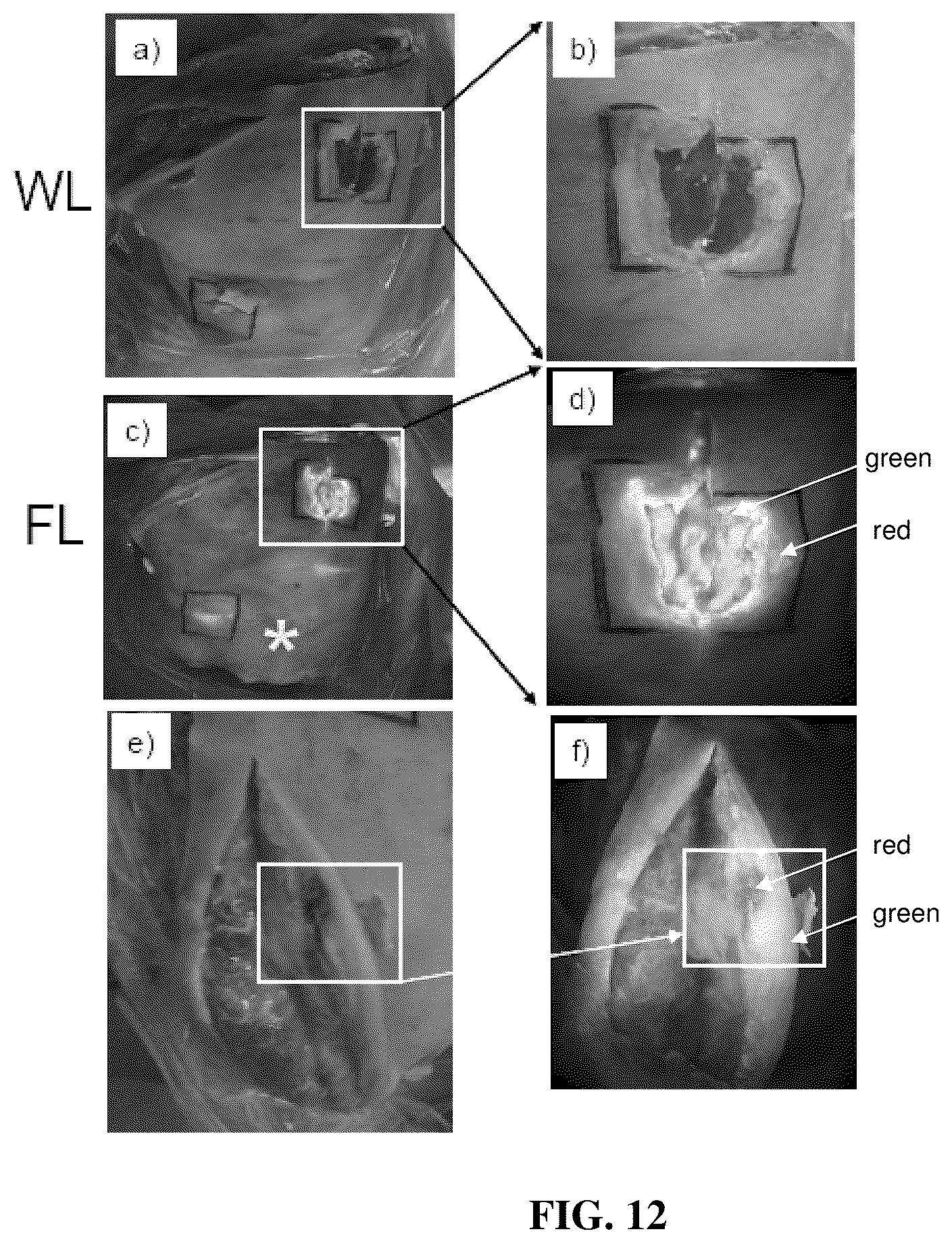 Patent US12586197 Figure 17 – Systems, devices, and methods for visualization of tissue and collection and analysis of data regarding same