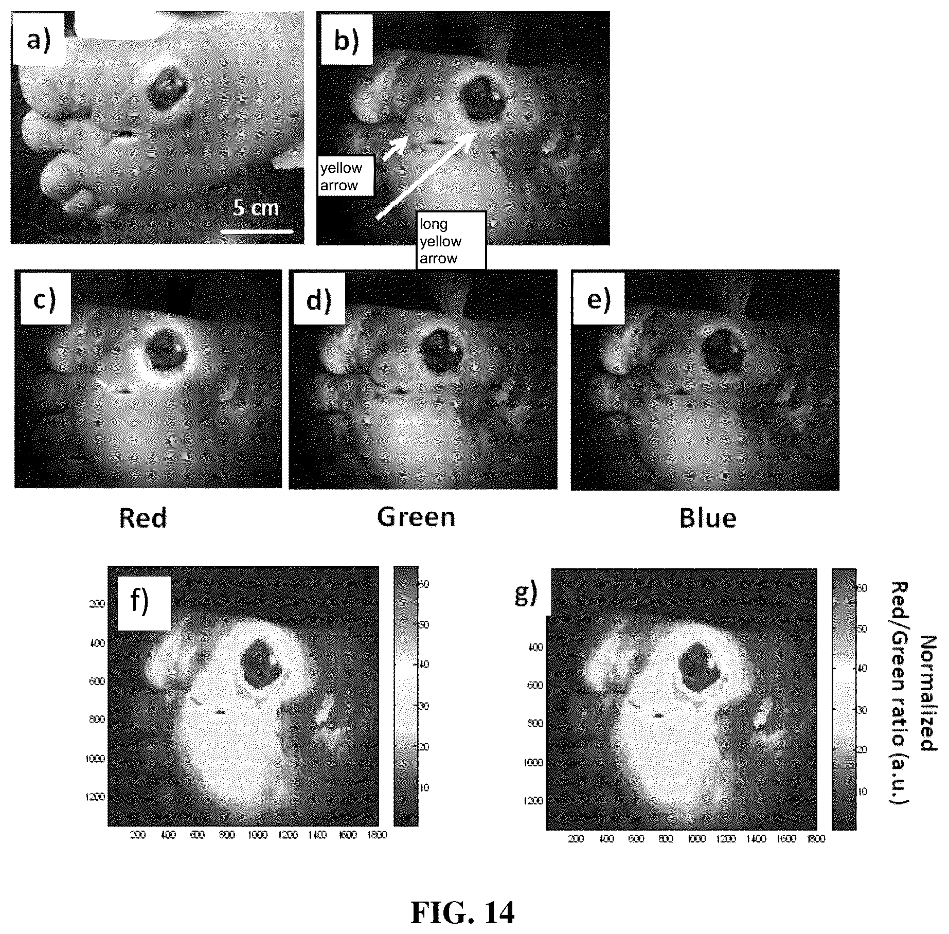 Patent US12586197 Figure 19 – Systems, devices, and methods for visualization of tissue and collection and analysis of data regarding same