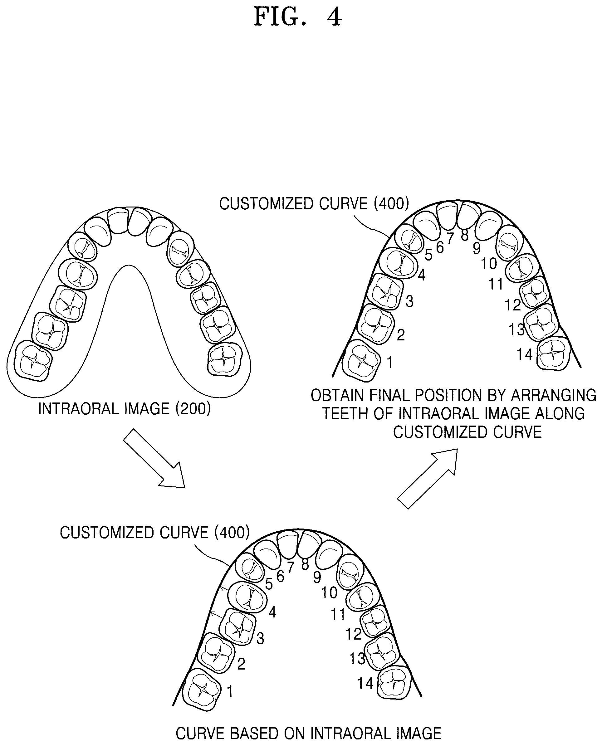 Patent US12586201 Figure 4 – Oral image processing device and oral image processing method