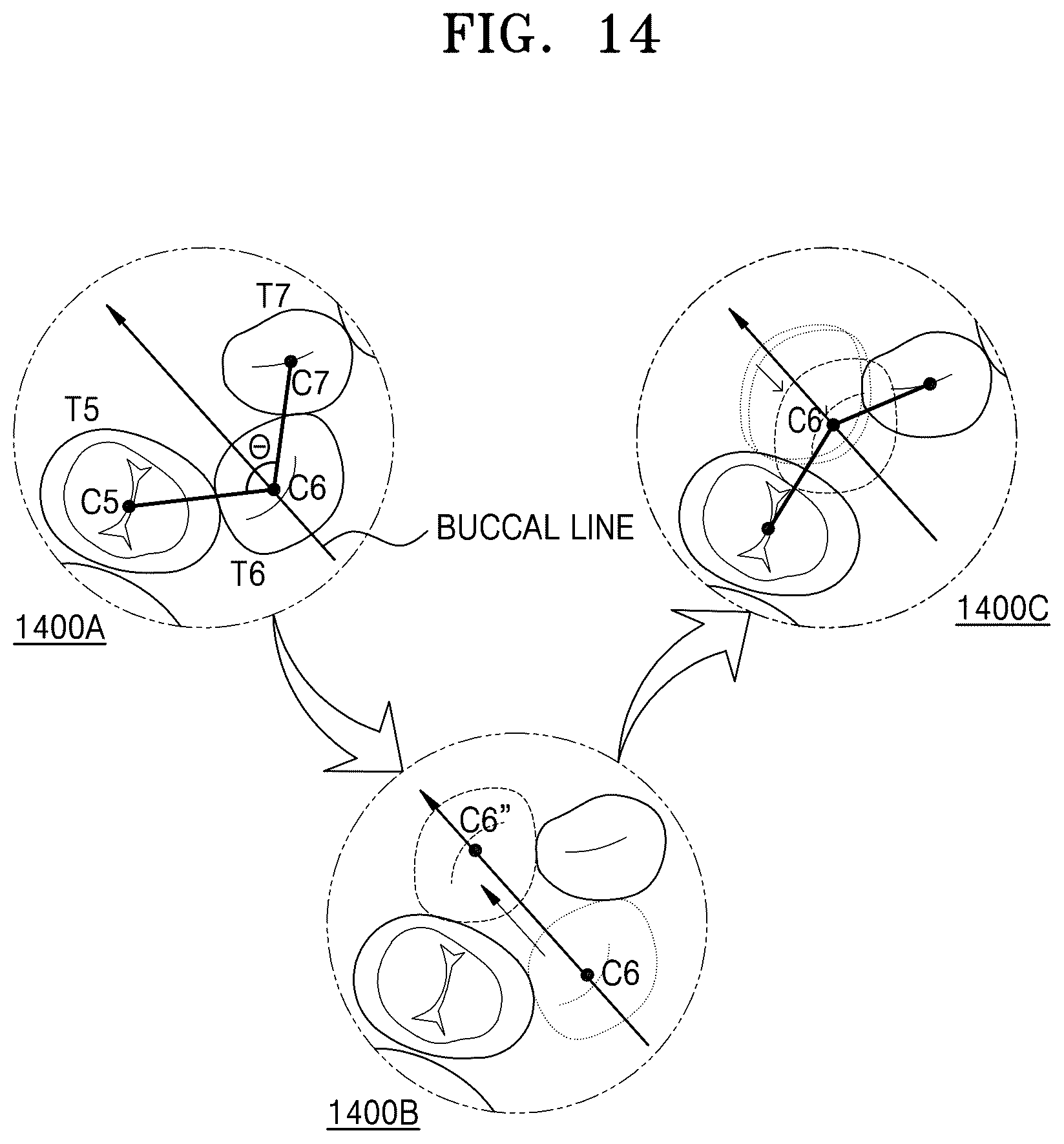 Patent US12586201 Figure 15 – Oral image processing device and oral image processing method