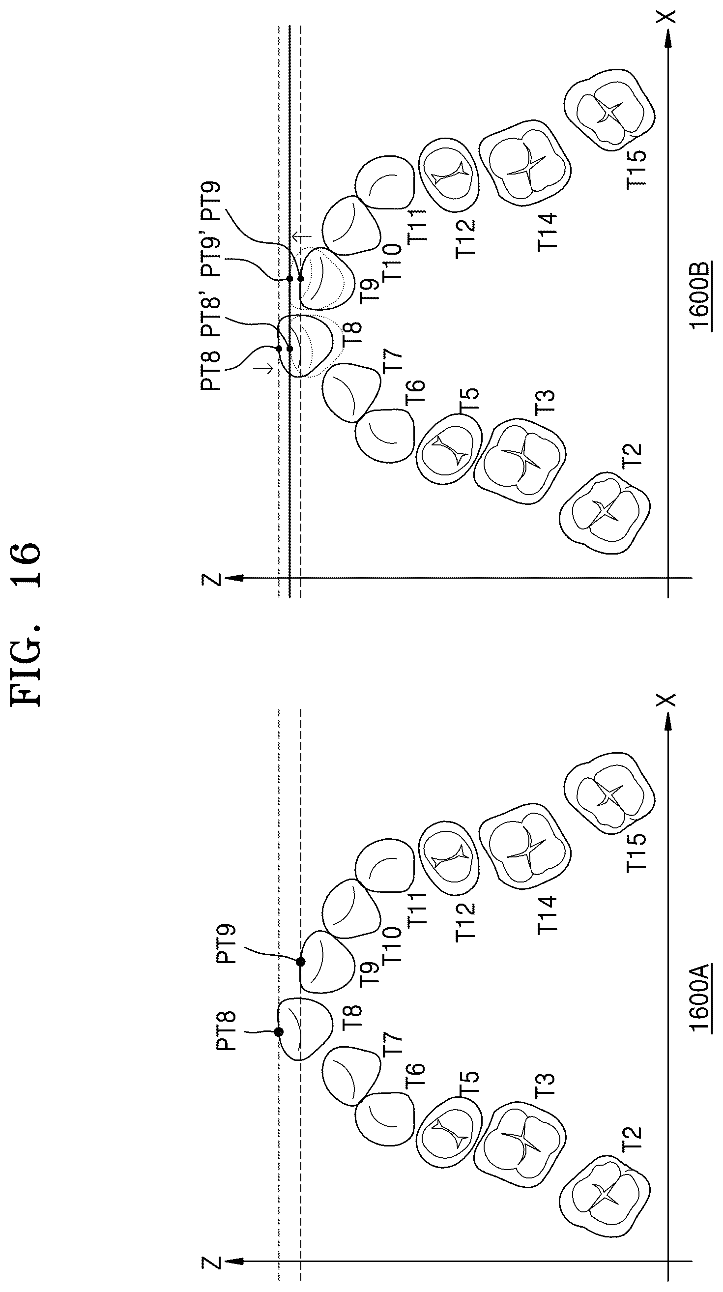 Patent US12586201 Figure 17 – Oral image processing device and oral image processing method