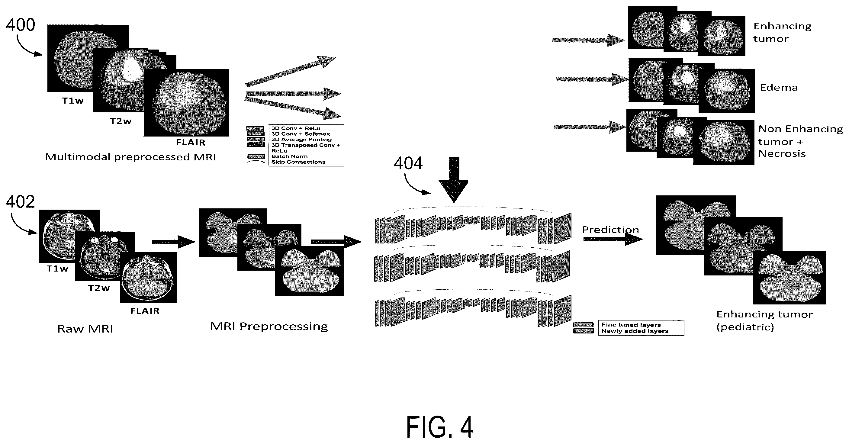 Patent US12586202 Figure 4 – System and method for automatic segmentation of tumor sub-compartments in pediatric cancer using multiparametric MRI