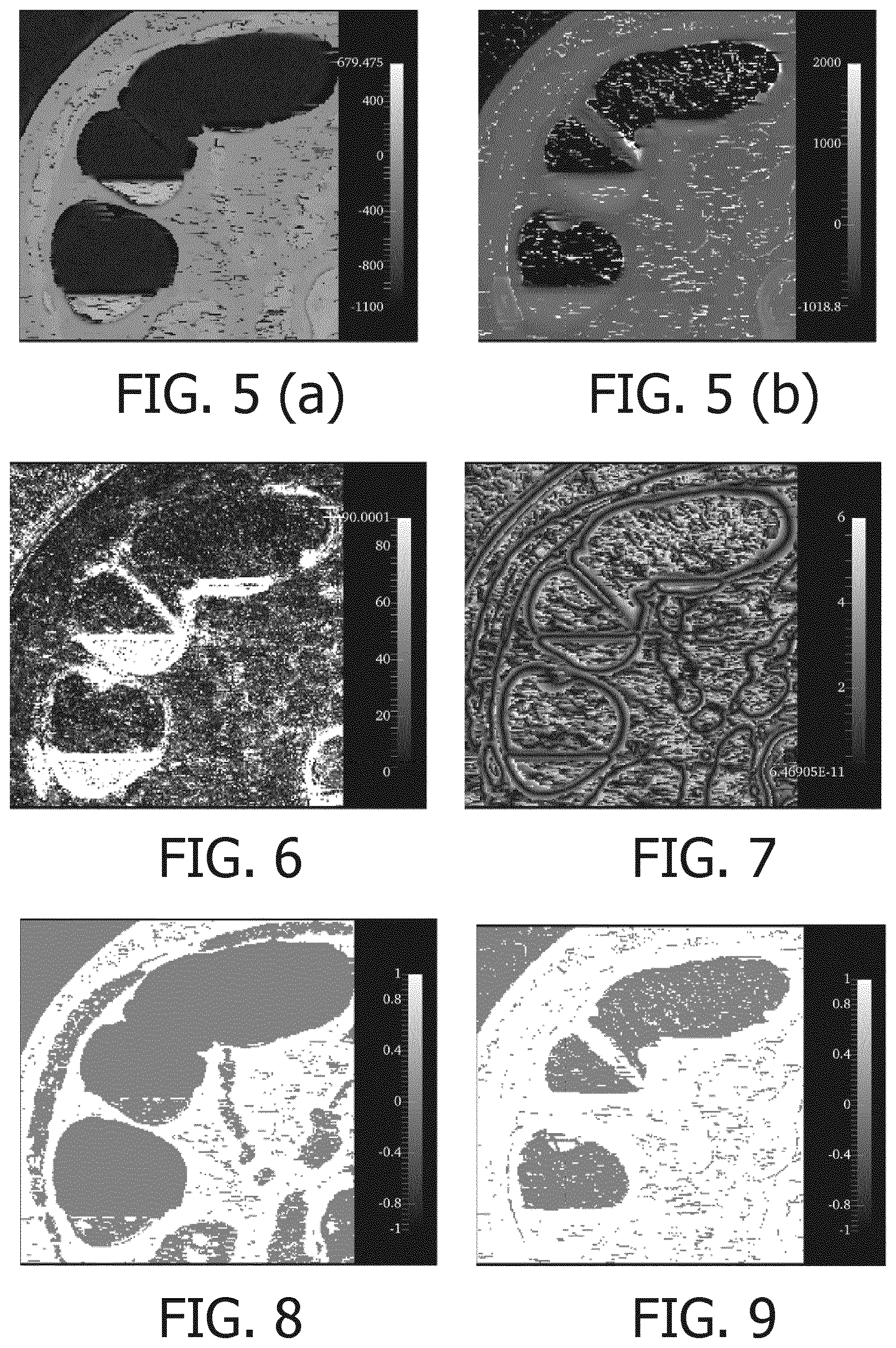Patent US12586206 Figure 3 – Method for identifying a material boundary in volumetric image data