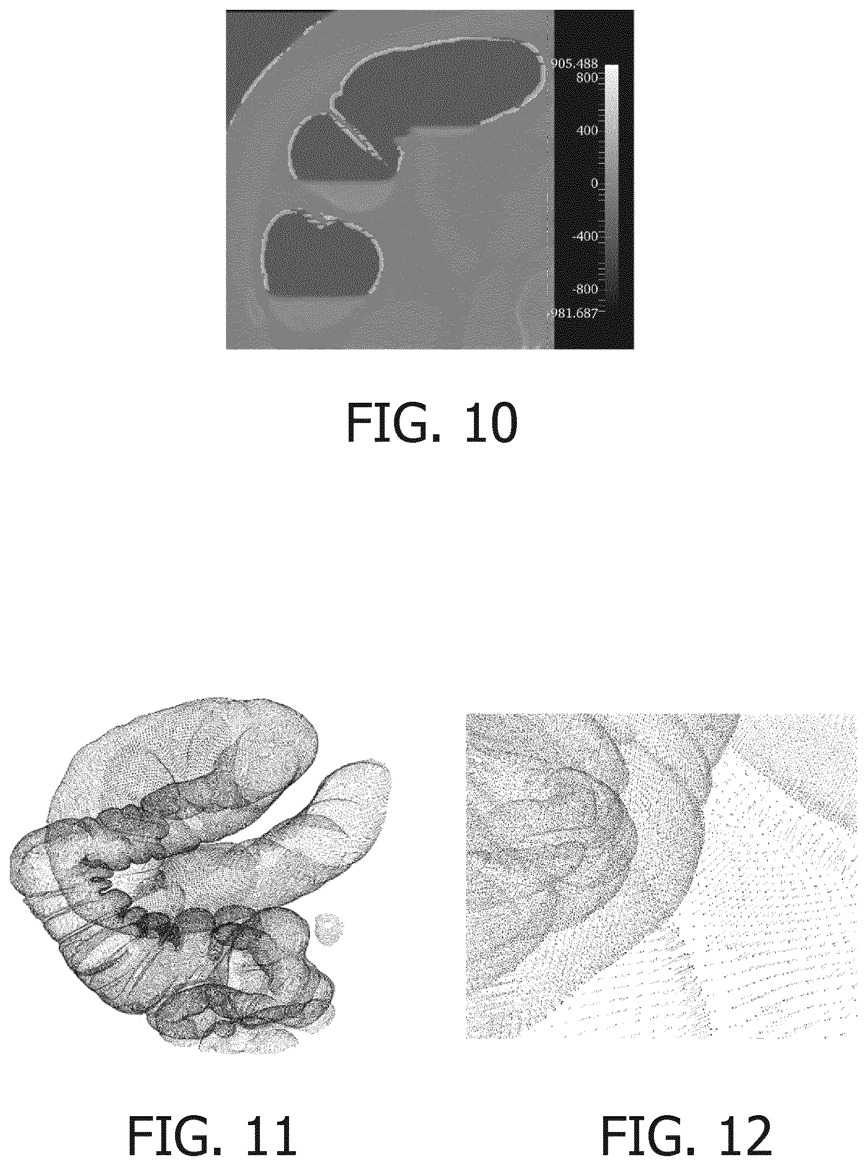 Patent US12586206 Figure 4 – Method for identifying a material boundary in volumetric image data